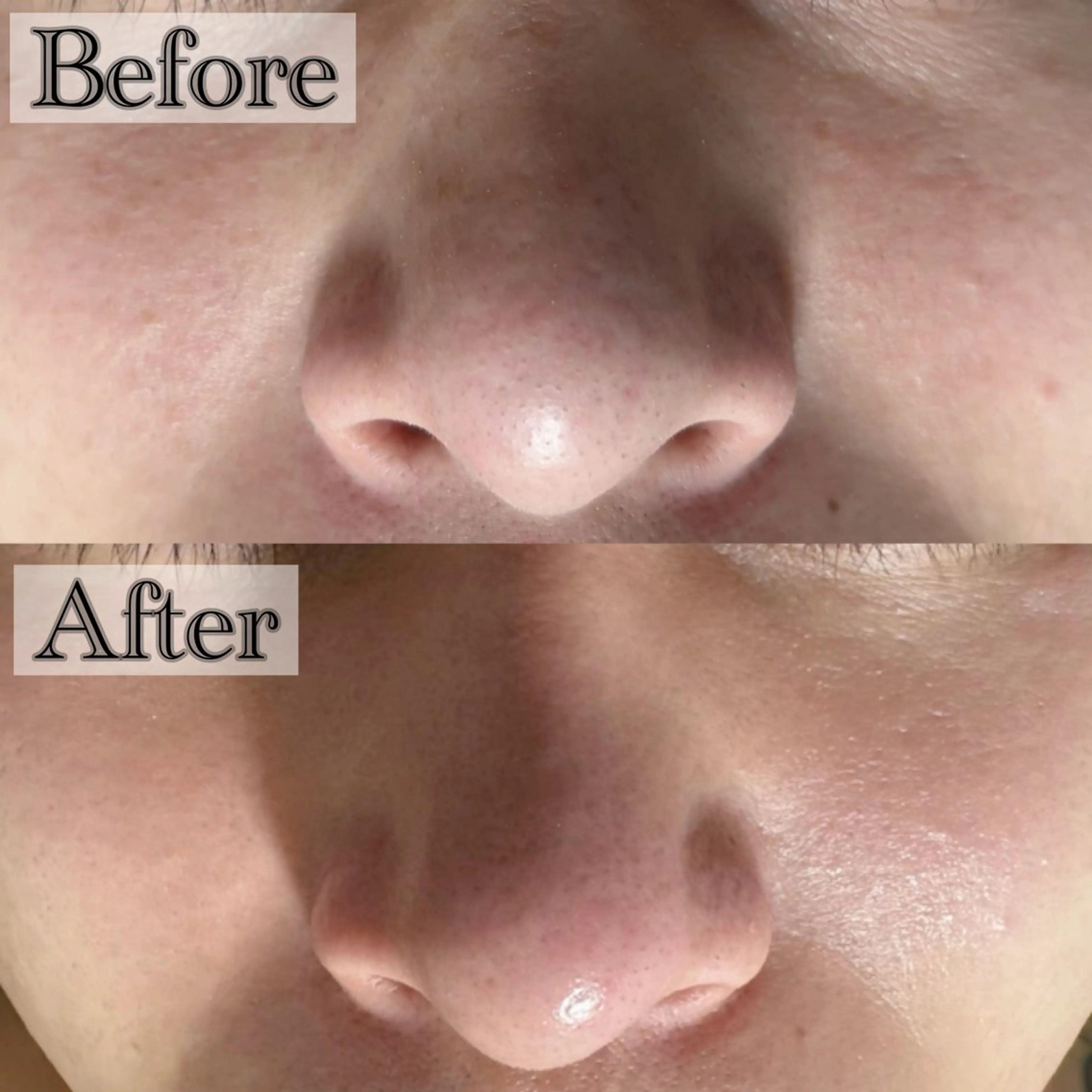 エステ 六本木/似合わせ眉毛 andＳ🍀Yuriのエステ・リラクイメージ