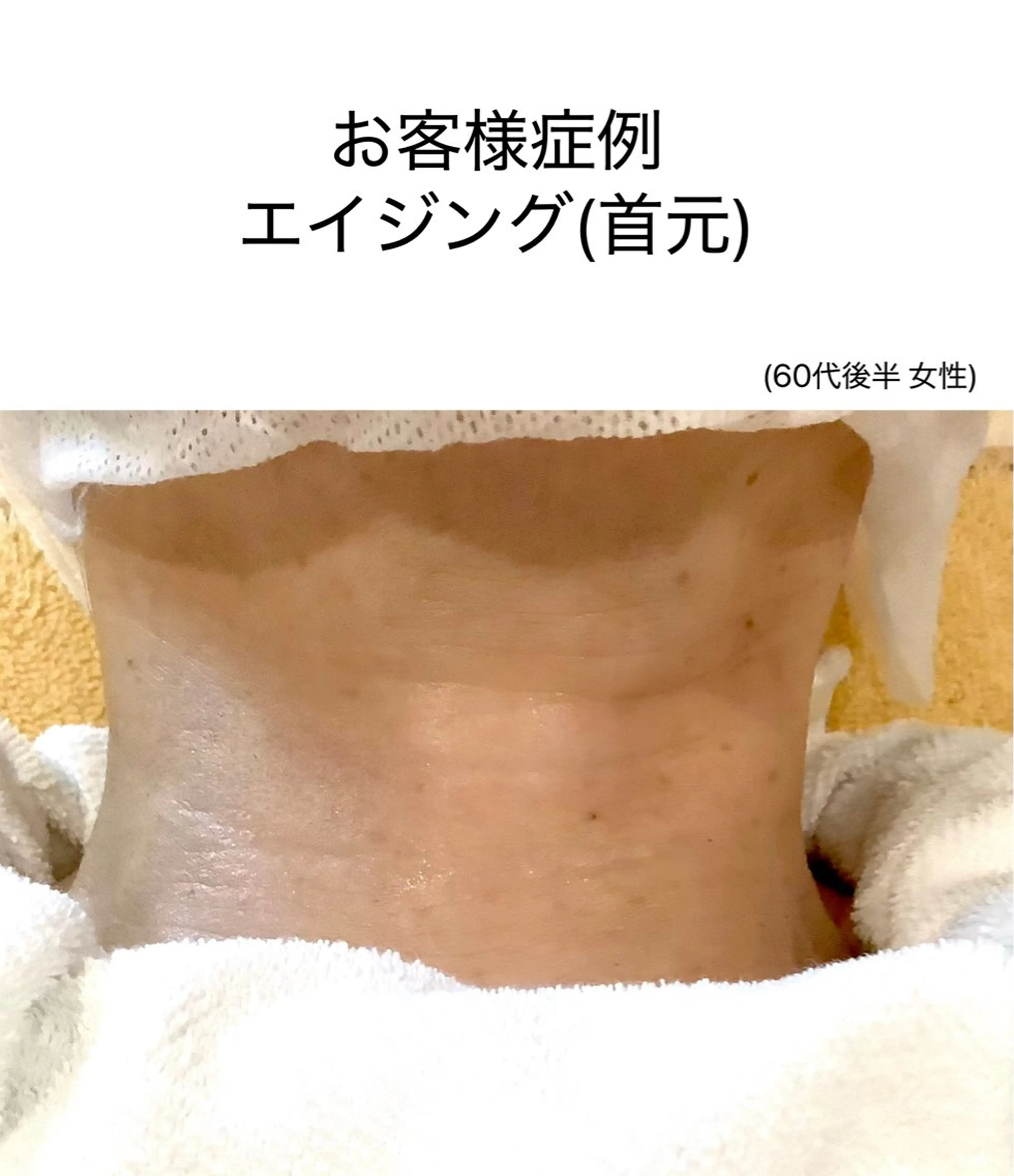 CPサロンビバーチェ所属・CPサロン ビバーチェのエステ・リラクイメージ