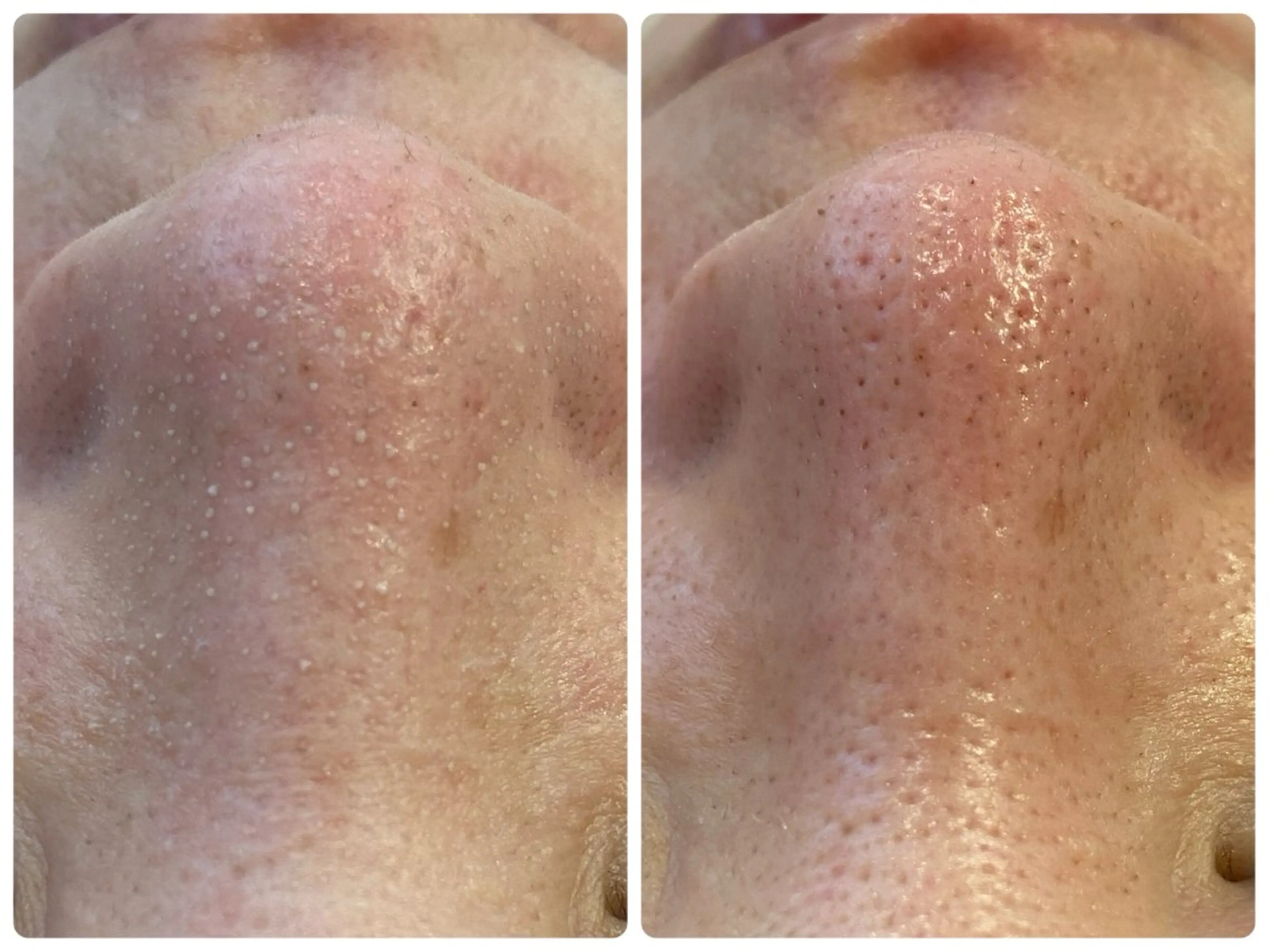 エステ Hisui 小出のエステ・リラクイメージ