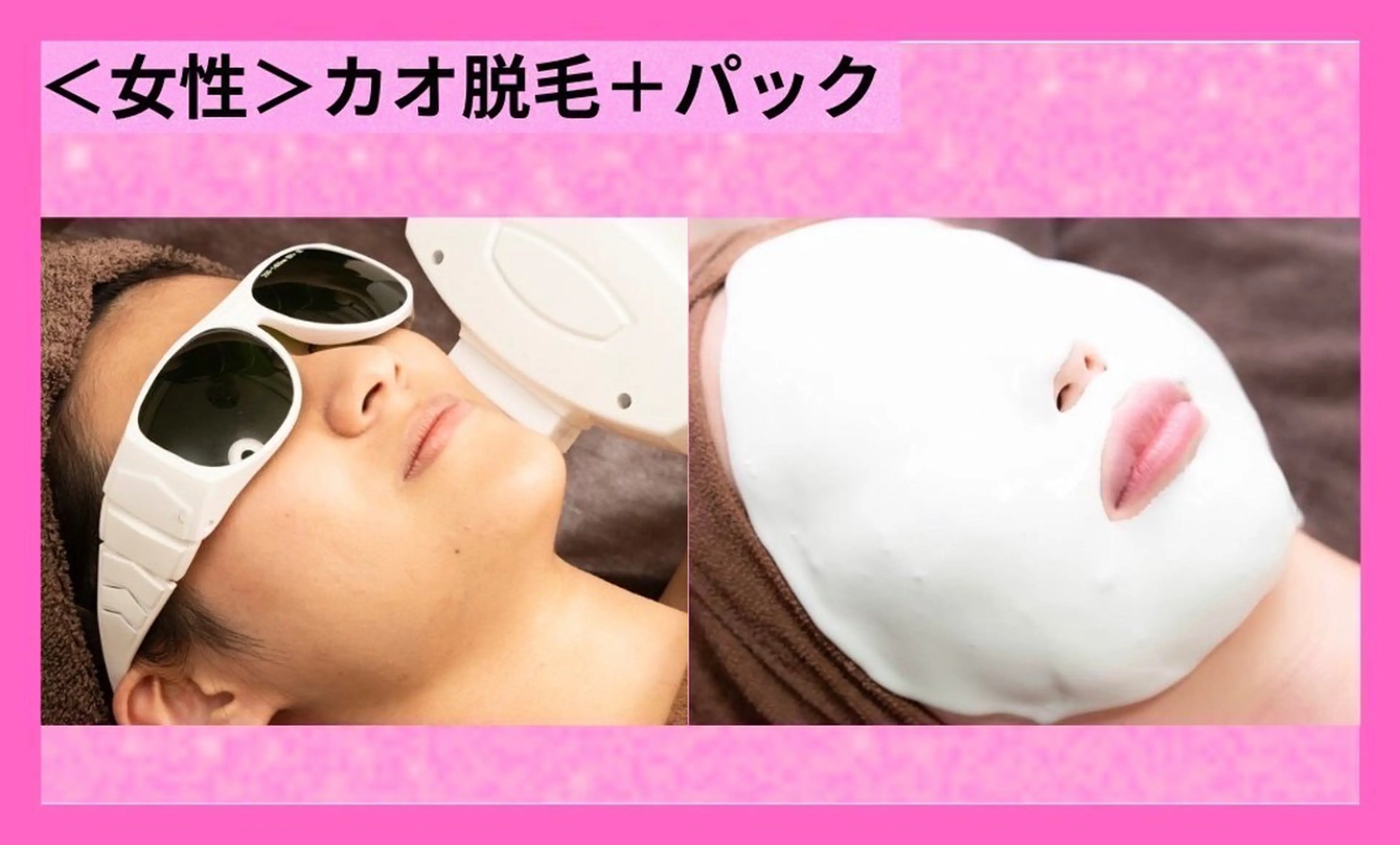 【女性脱毛】お顔の脱毛！1回2.200円スペシャルパック付き クレンジング付きの写真