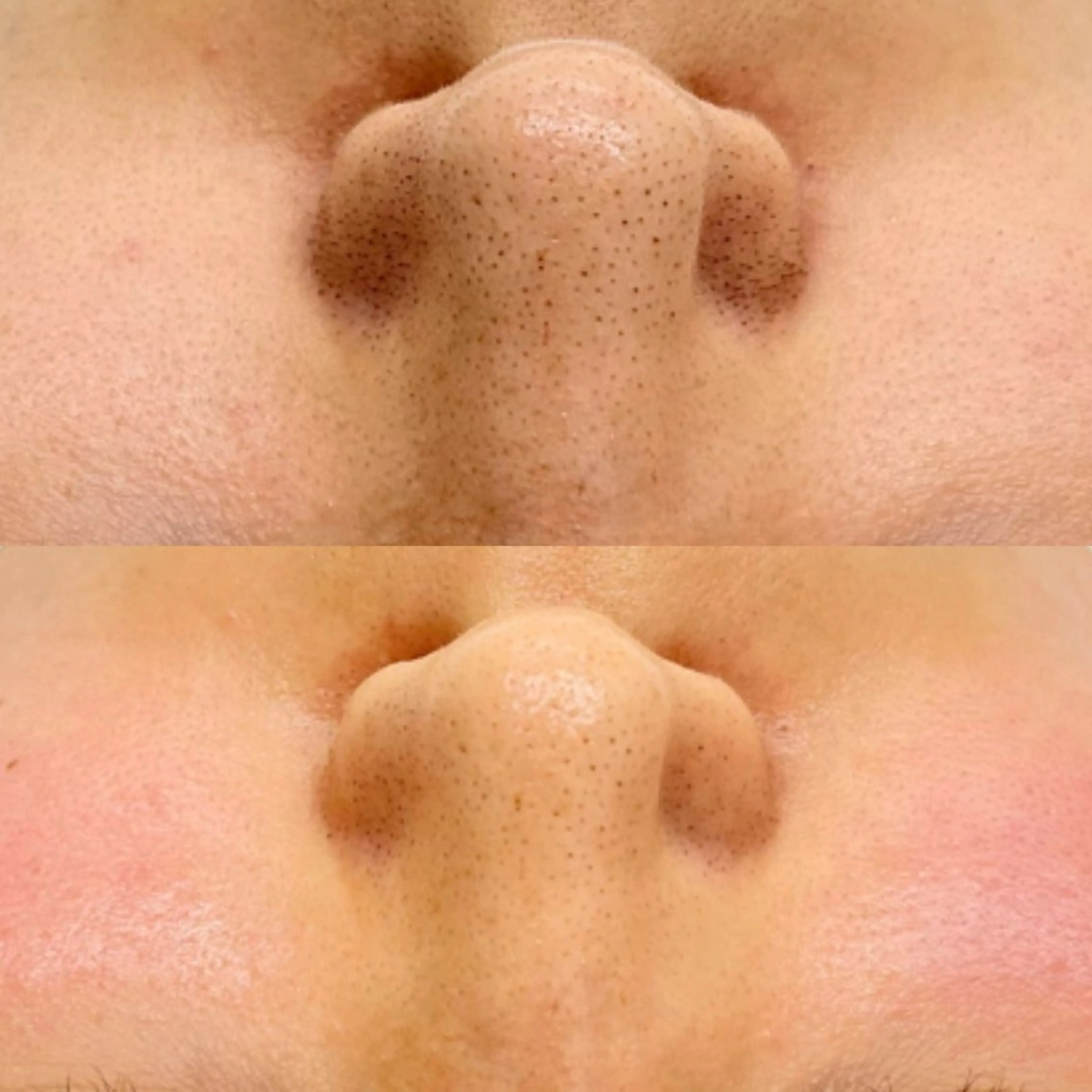 エステ 肌活＋温活サロン ハレオンナのエステ・リラクイメージ