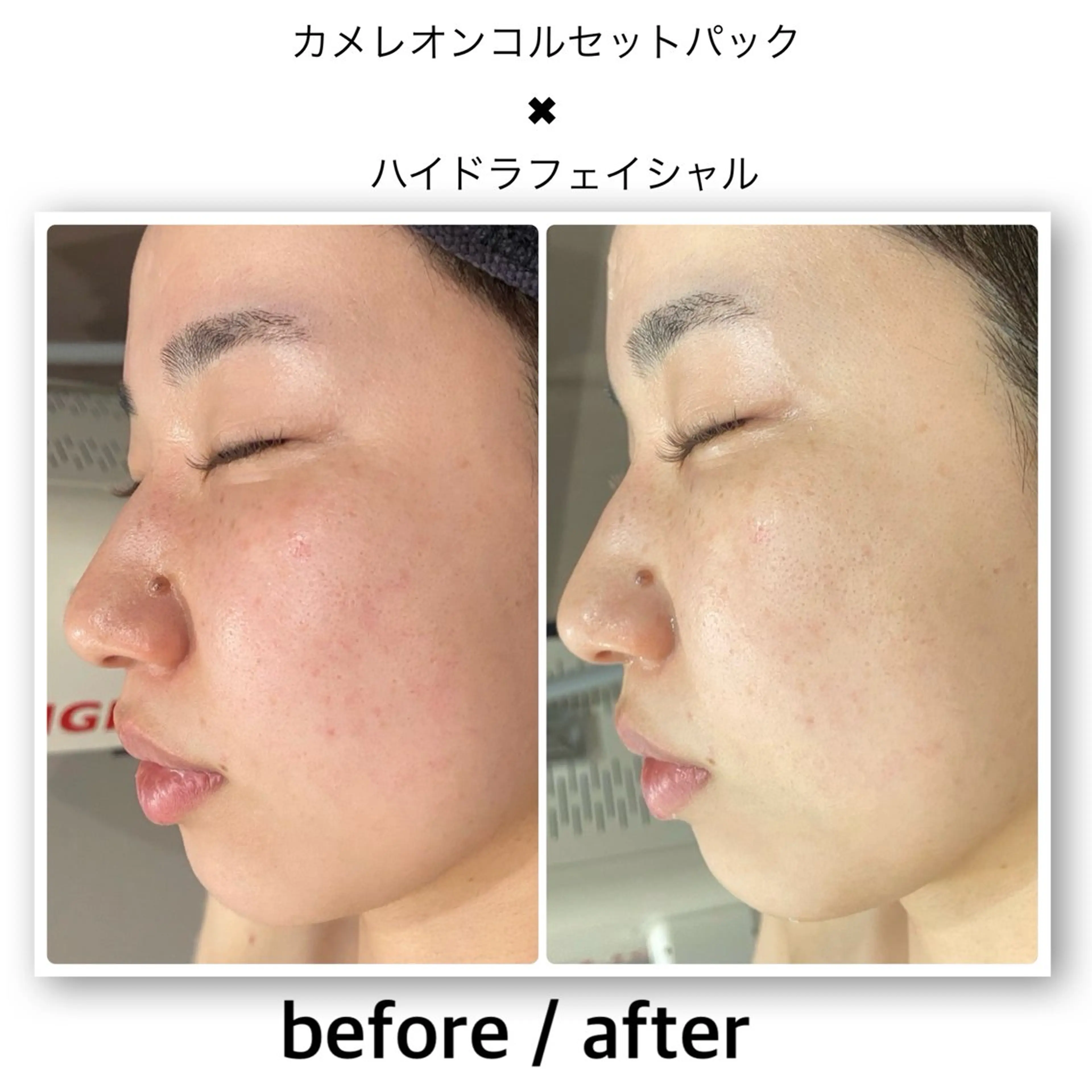 エステ クラスペディア脱毛 ・フェイシャル専門店のエステ・リラクイメージ