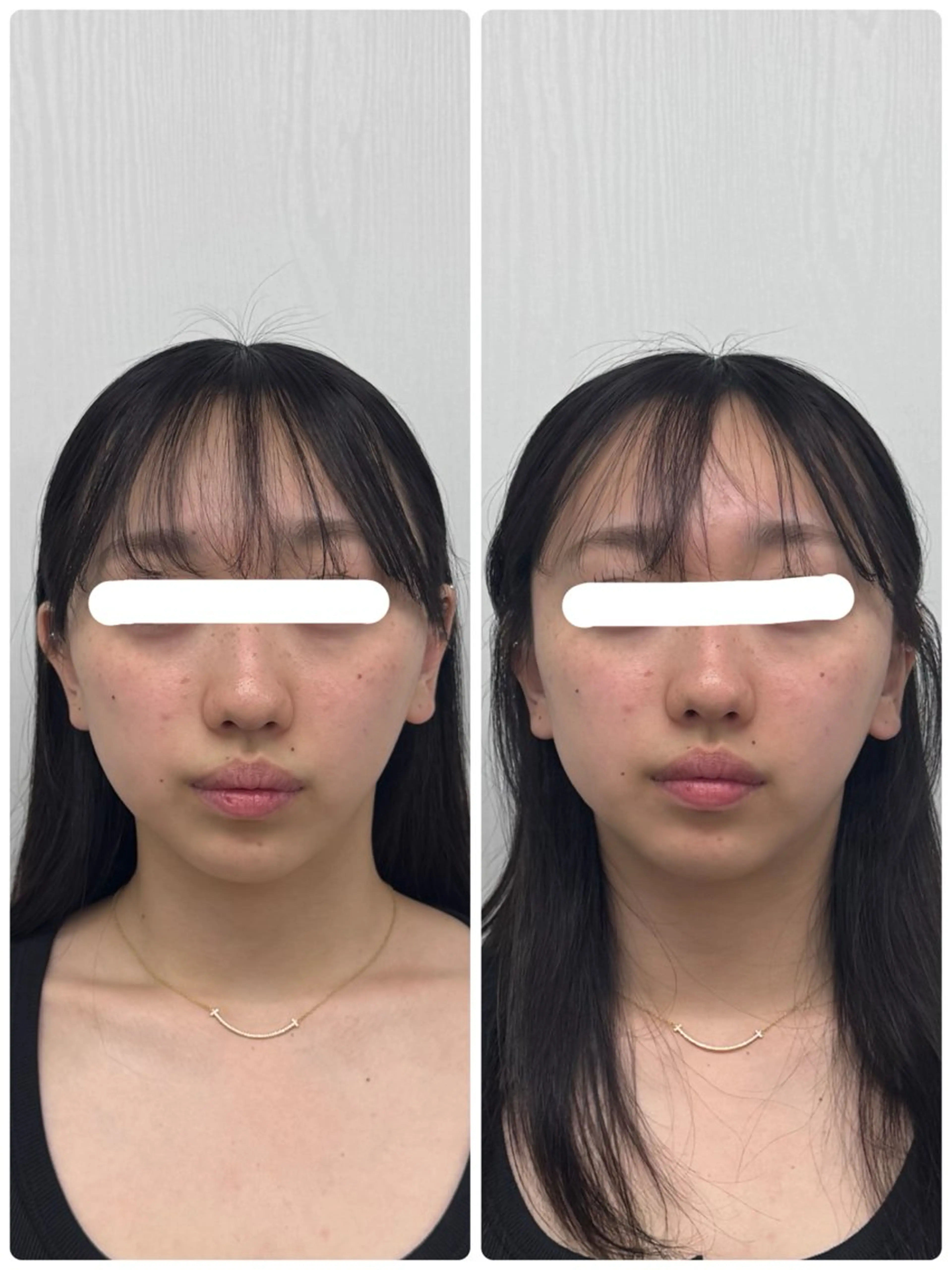 エステ リラク 美容鍼×小顔矯正 ×美容整体　浜川泰仁のエステ・リラクイメージ