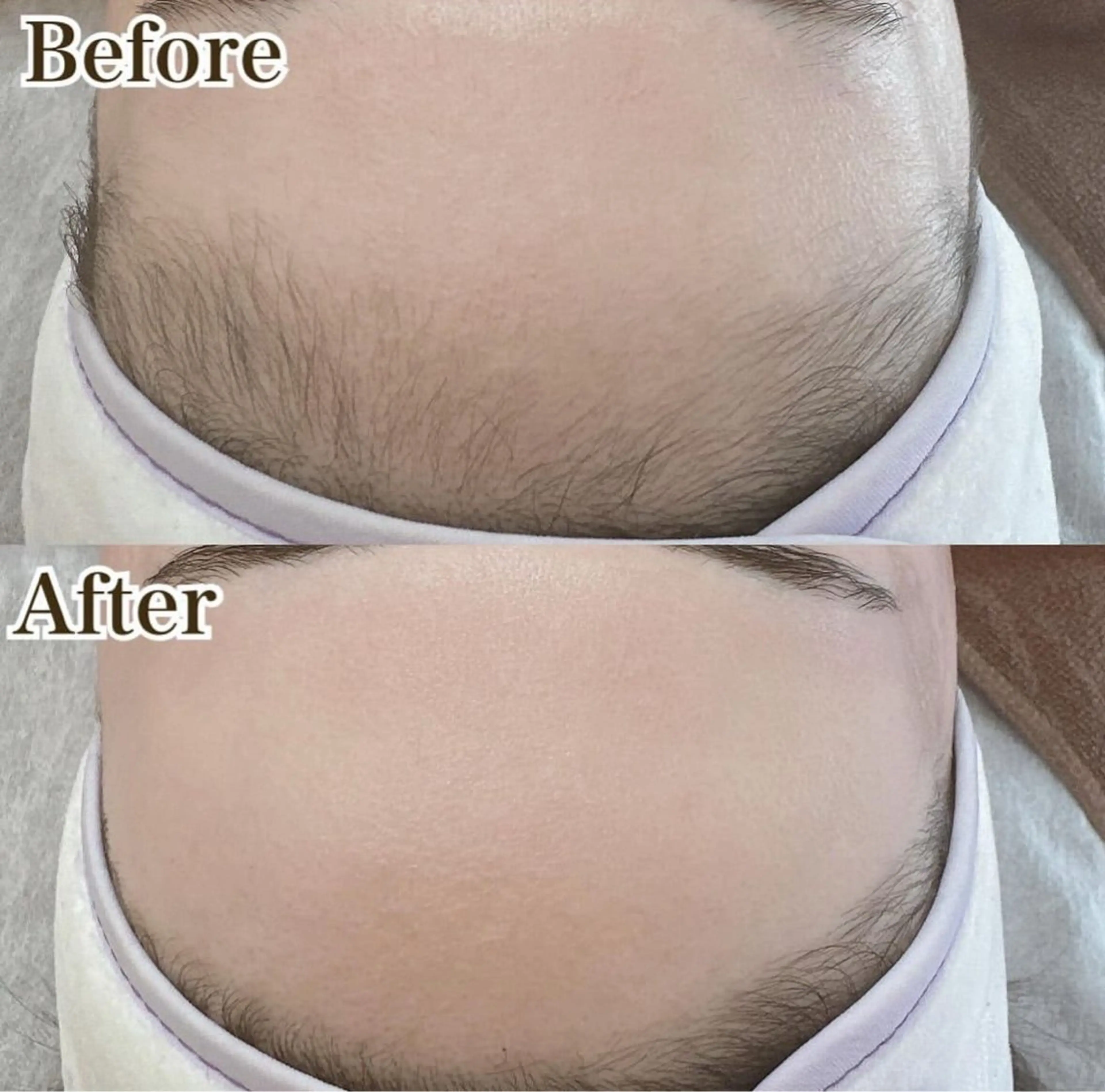 脱毛 金城 幸のエステ・リラクイメージ