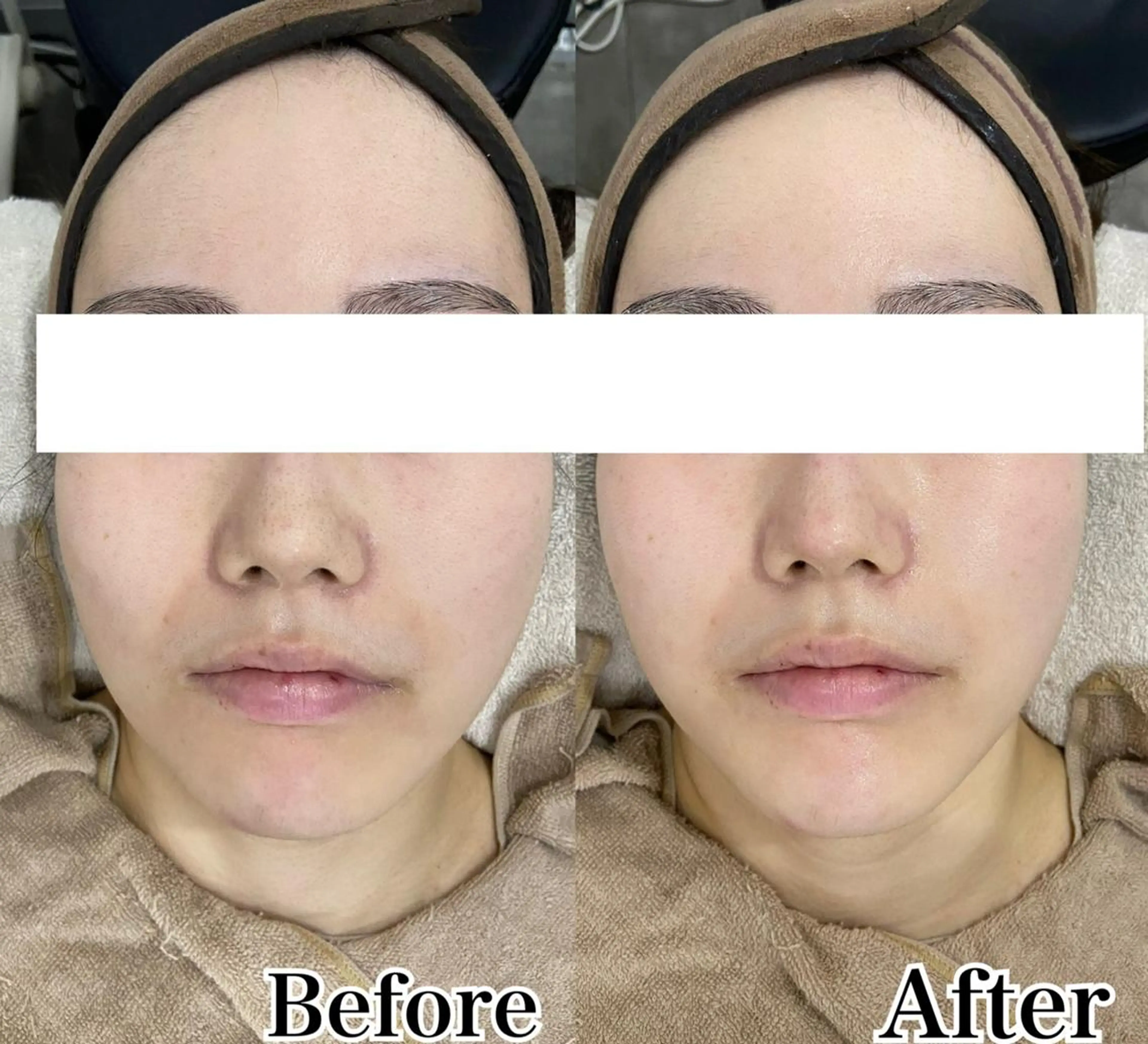 美肌サロンTIAM by tetoteのエステ・リラクイメージ