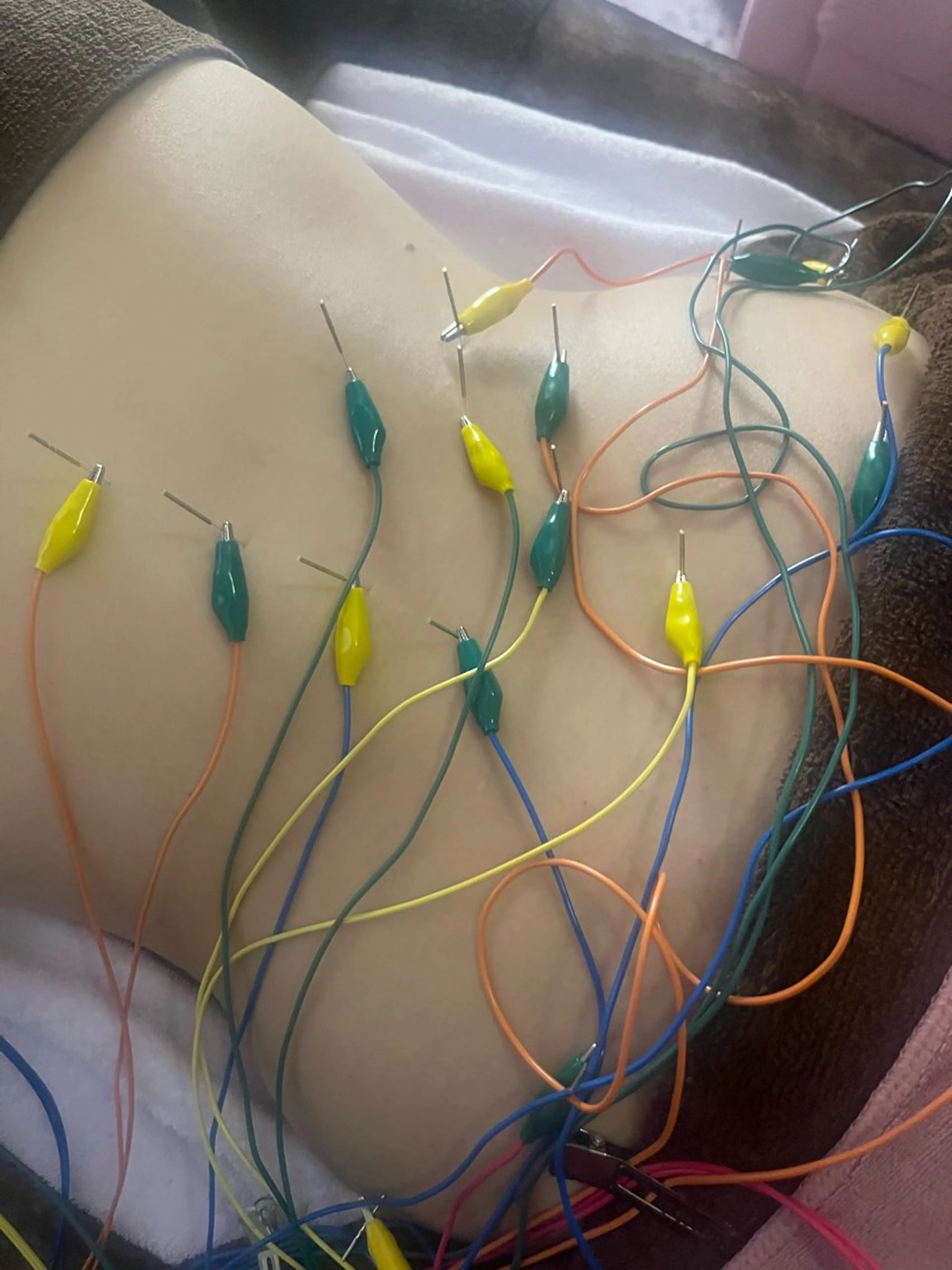 リラク アロマ･美容鍼･カッ ピング「麗」鍼灸院のエステ・リラクイメージ