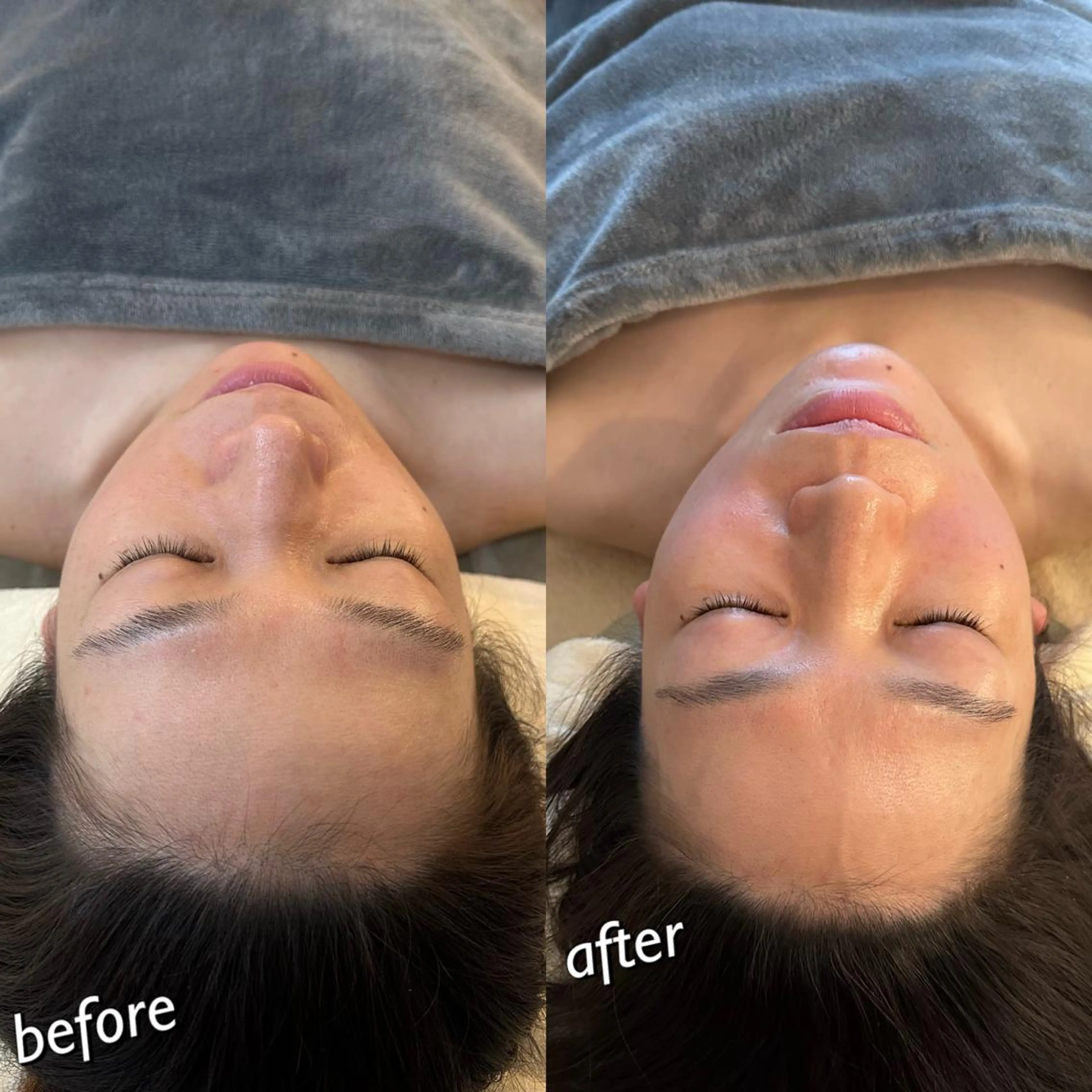 うなじ脱毛/美肌脱毛 LABELのエステ・リラクイメージ