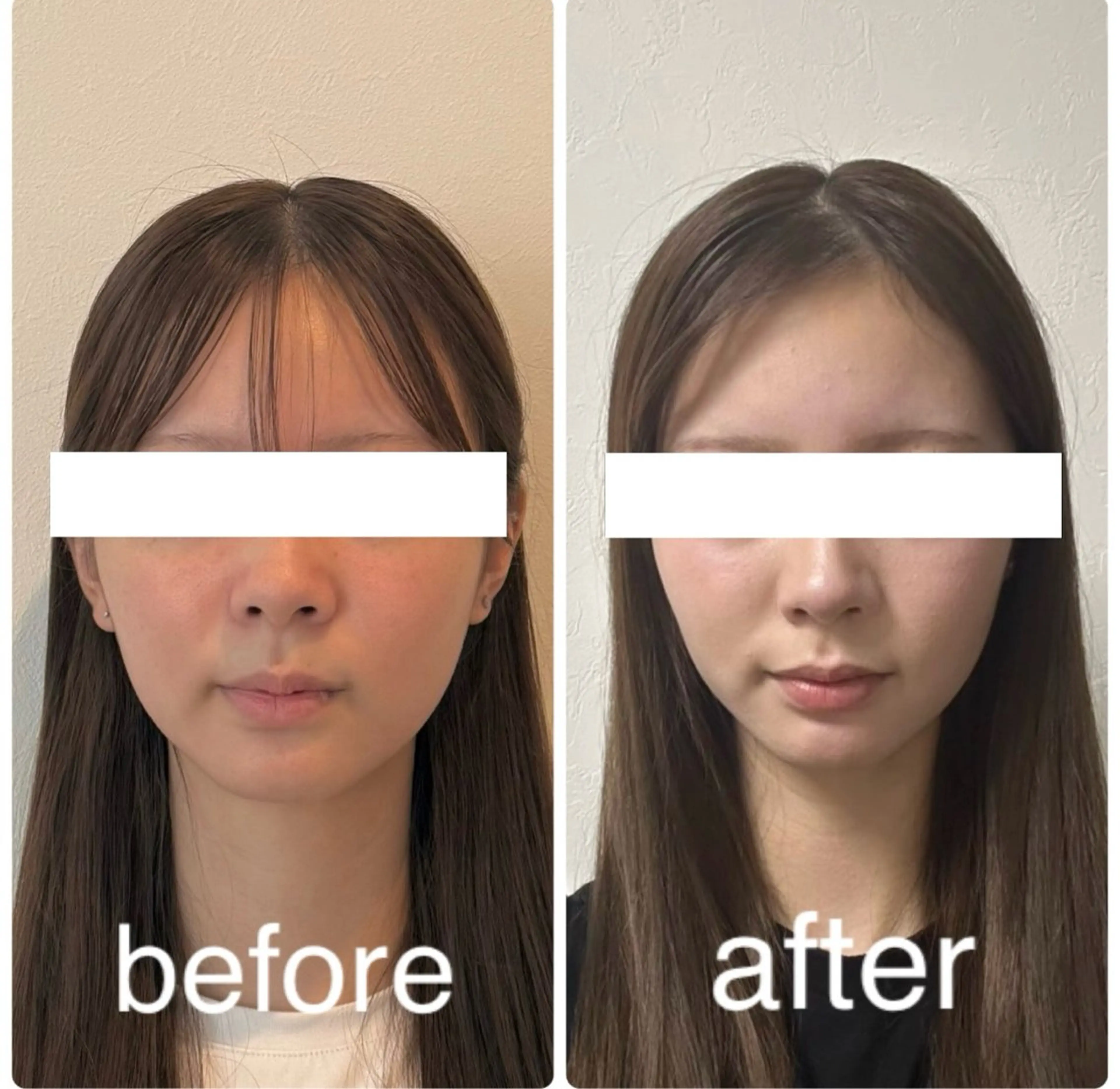 エステ リラク 小顔と ヘッドスパのお店のエステ・リラクイメージ