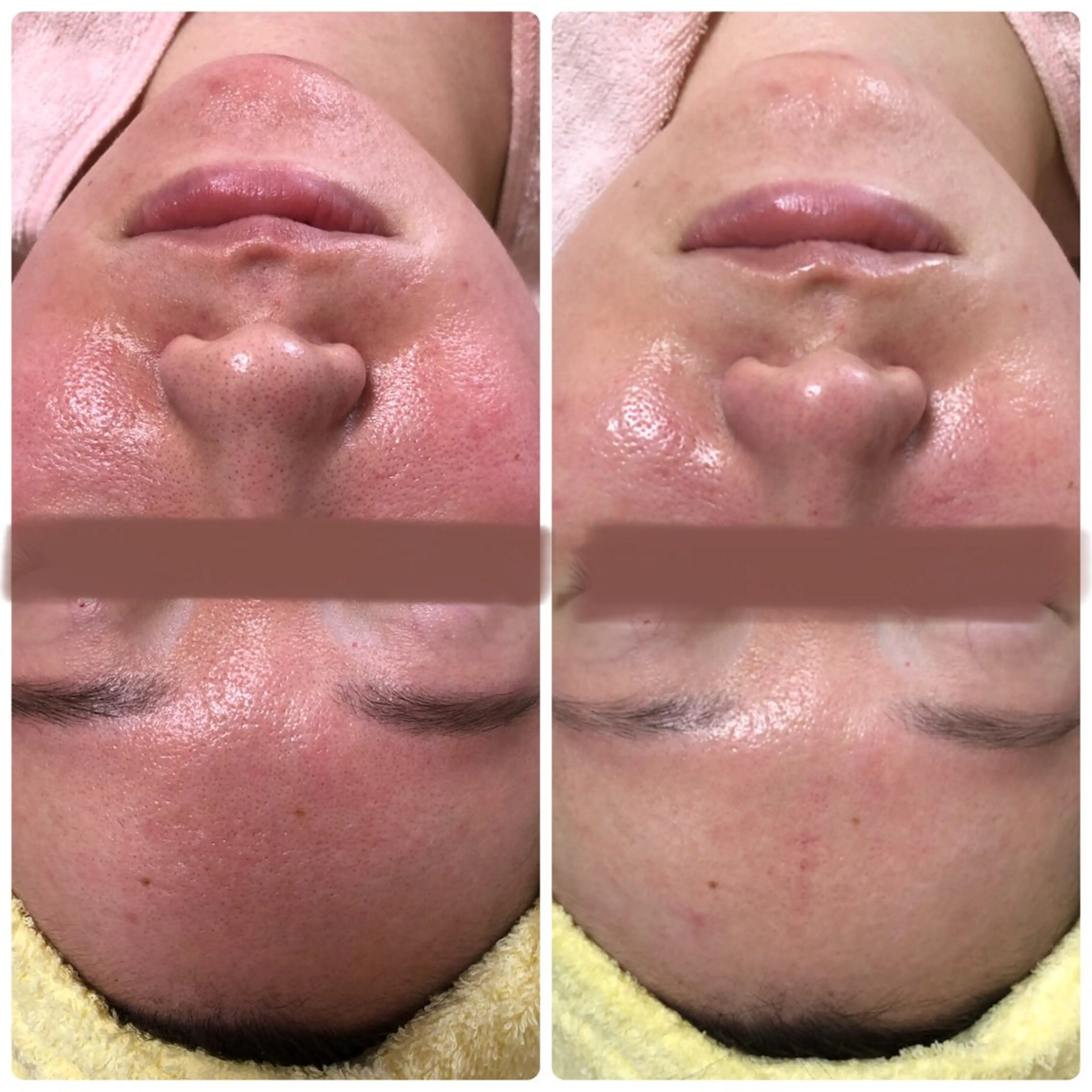 Wax/絹肌艶肌🌼 坂結加のエステ・リラクイメージ