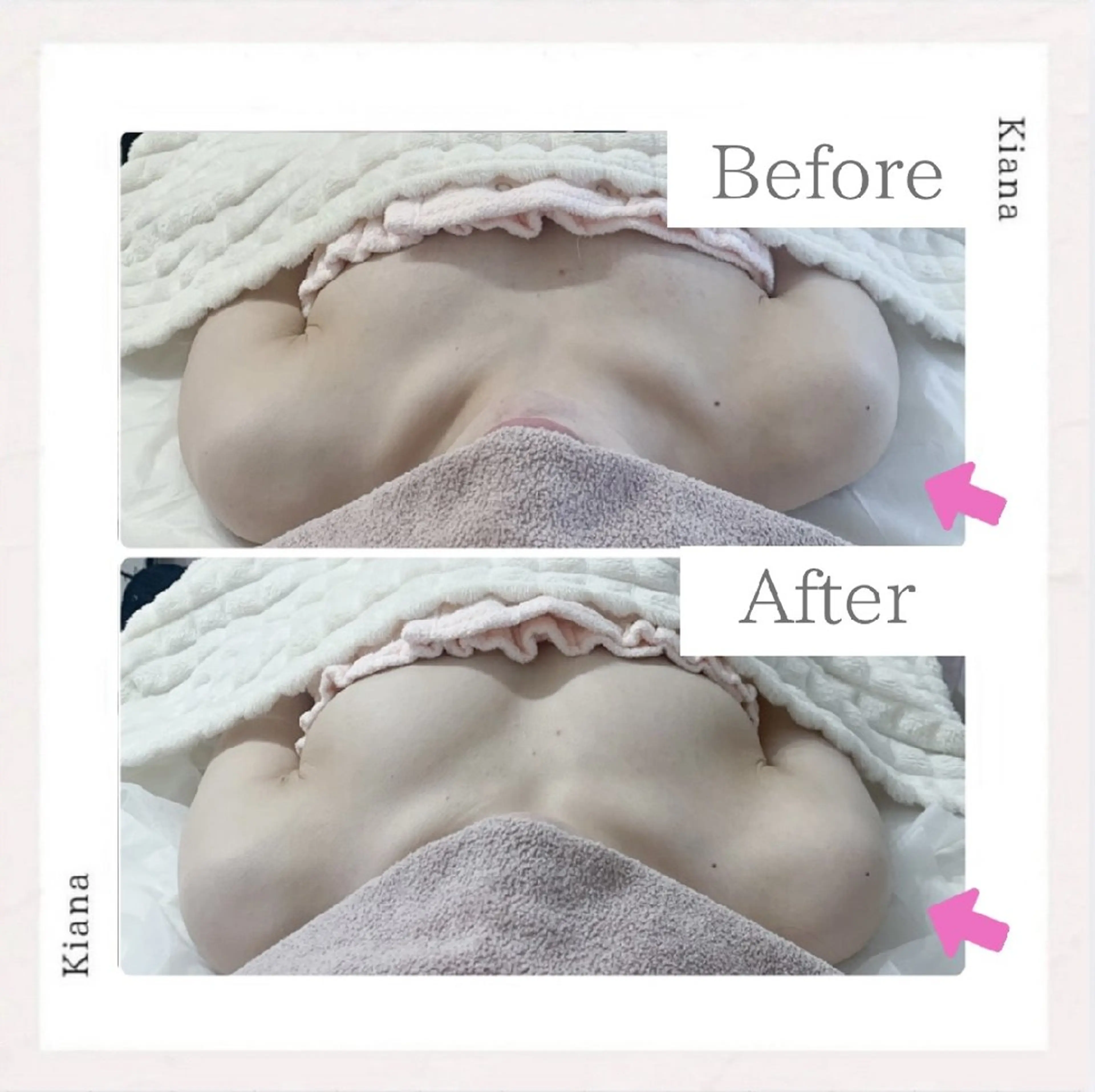 エステ リラク 【バスト専門店 】 Kiana のエステ・リラクイメージ