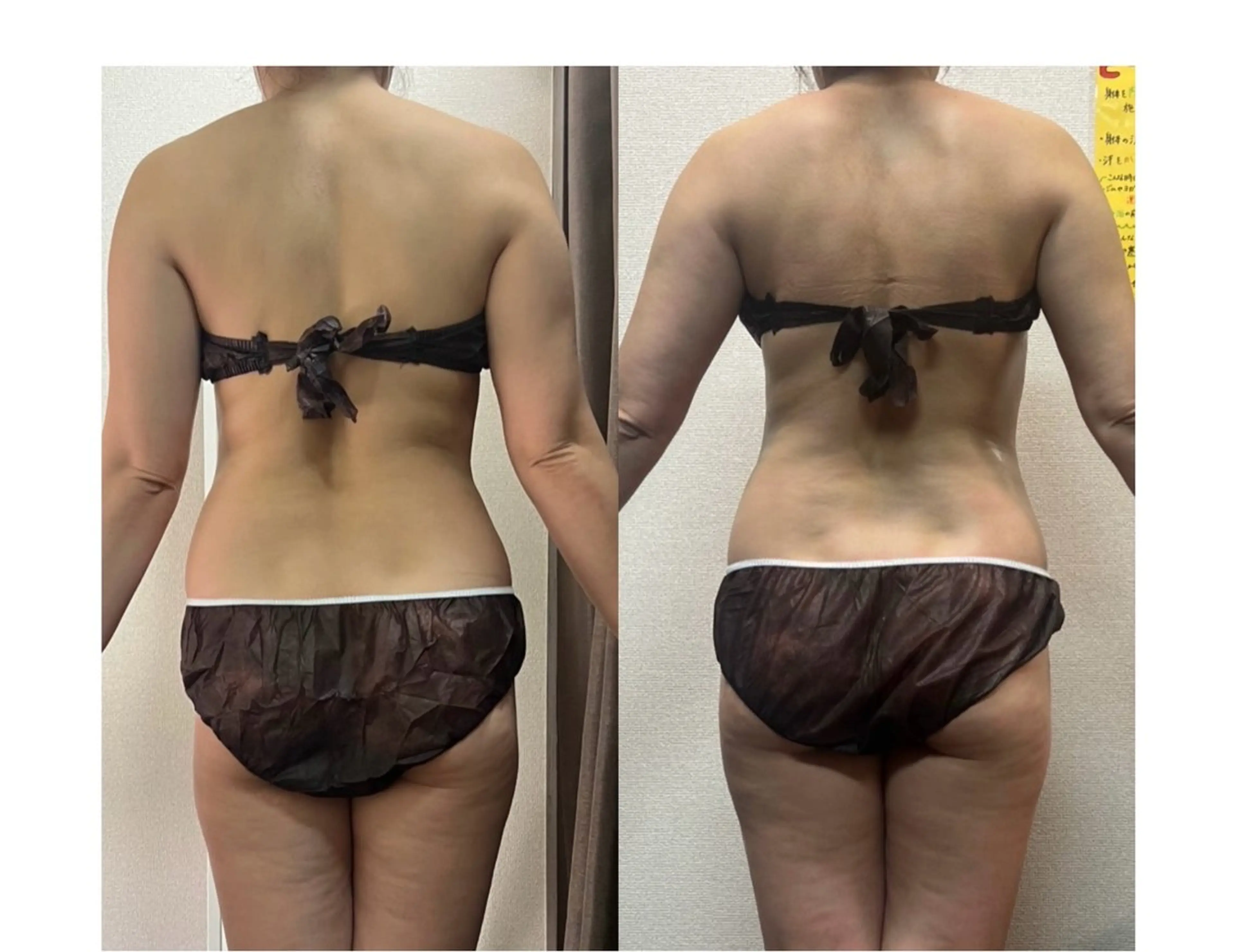 ハイパーナイフ専門店　Salon de COCO所属・Salon de COCOのエステ・リラクイメージ