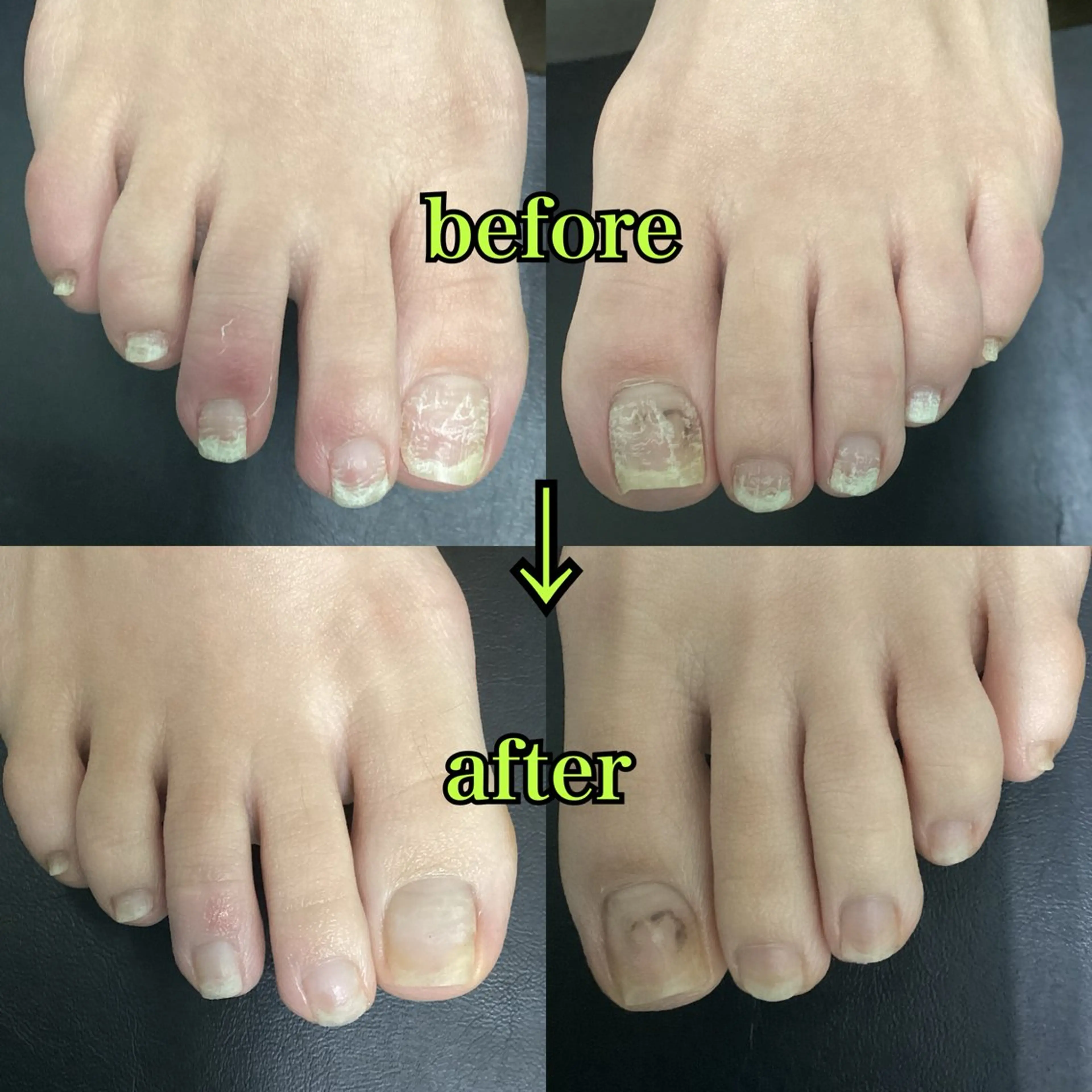 【ハンドorフット】爪のお手入れ  10本の写真