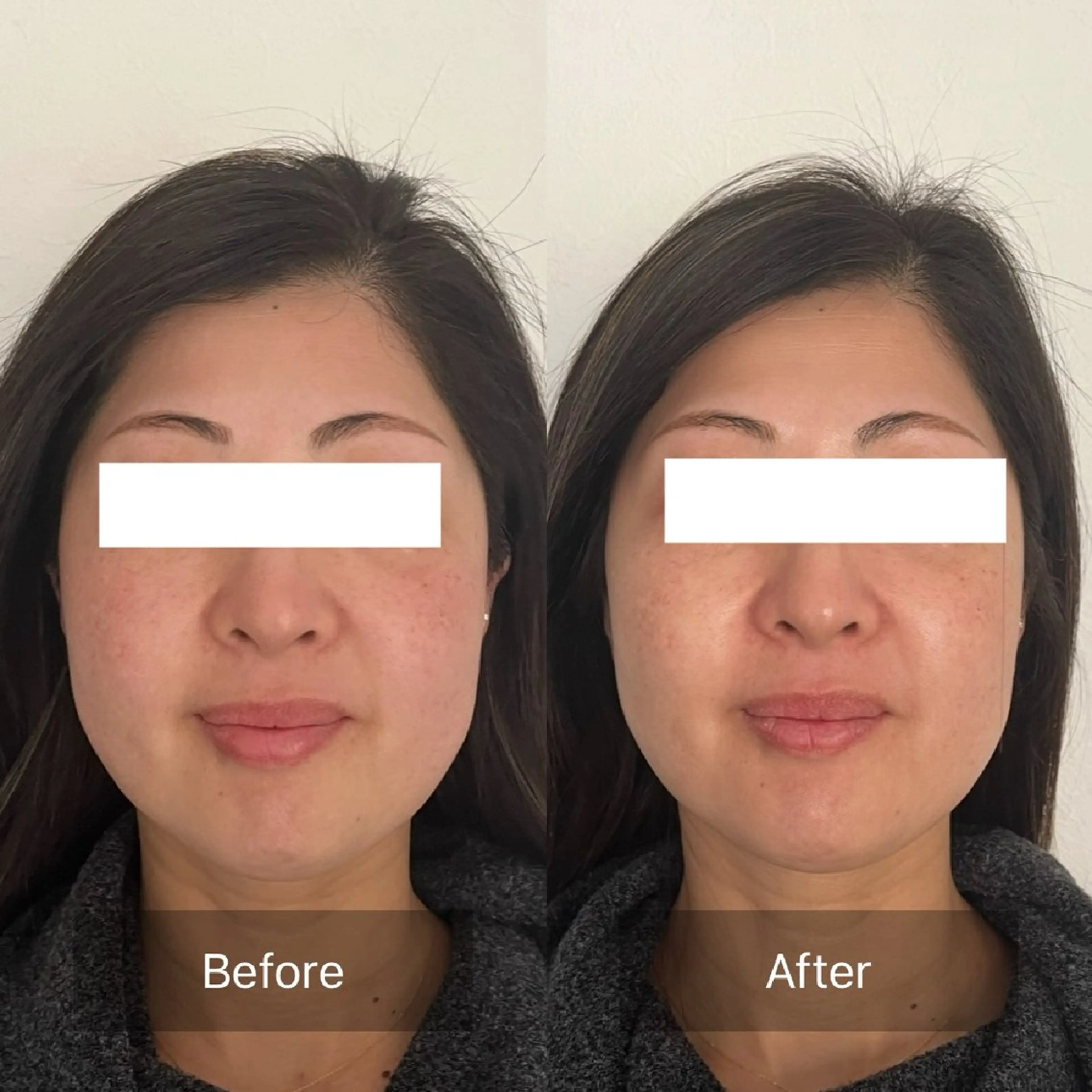 エステ リラク 小顔・歪み専門　井元 朋子のエステ・リラクイメージ