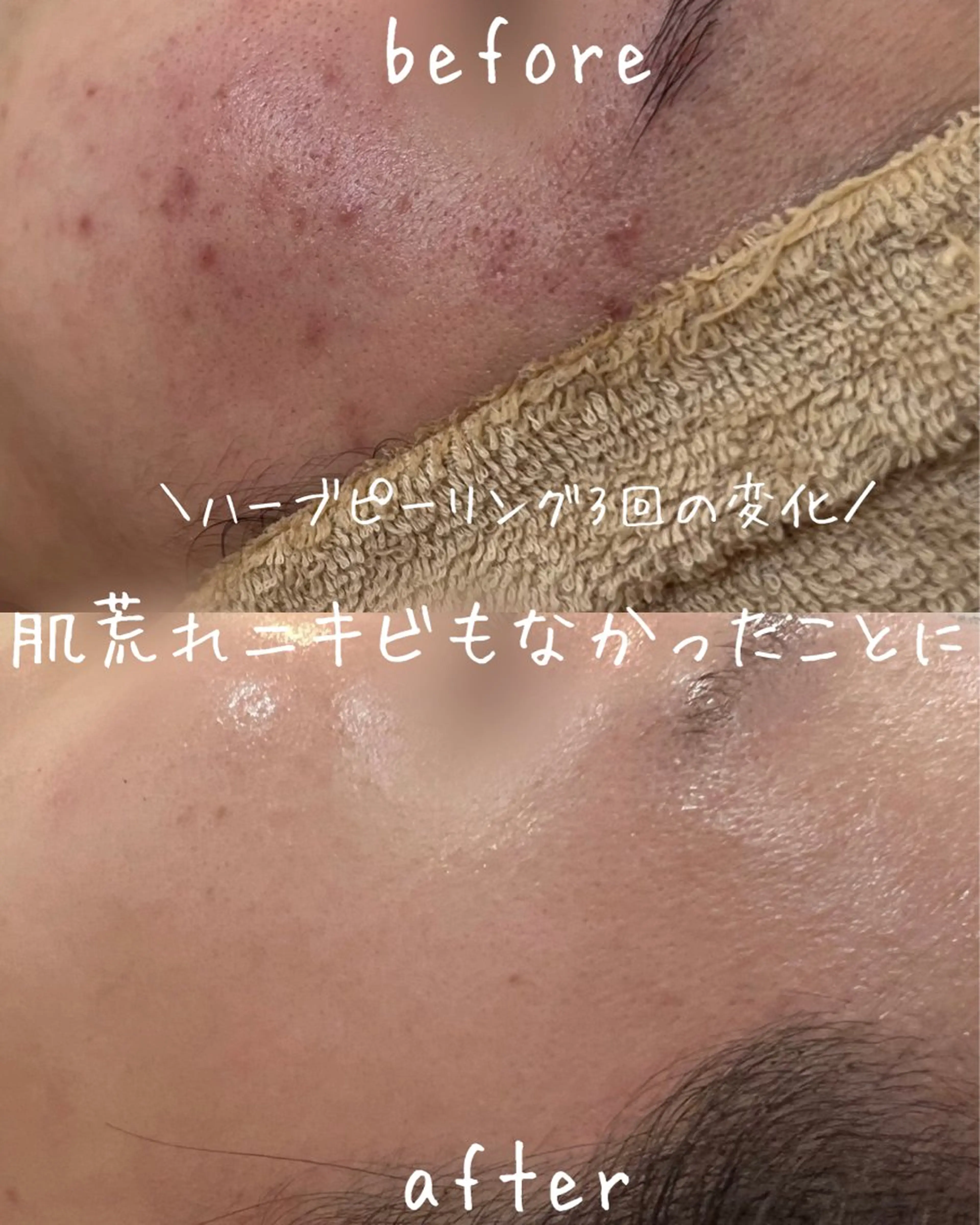 エステ ｍｉkｉ 東根の肌質改善サロンのエステ・リラクイメージ