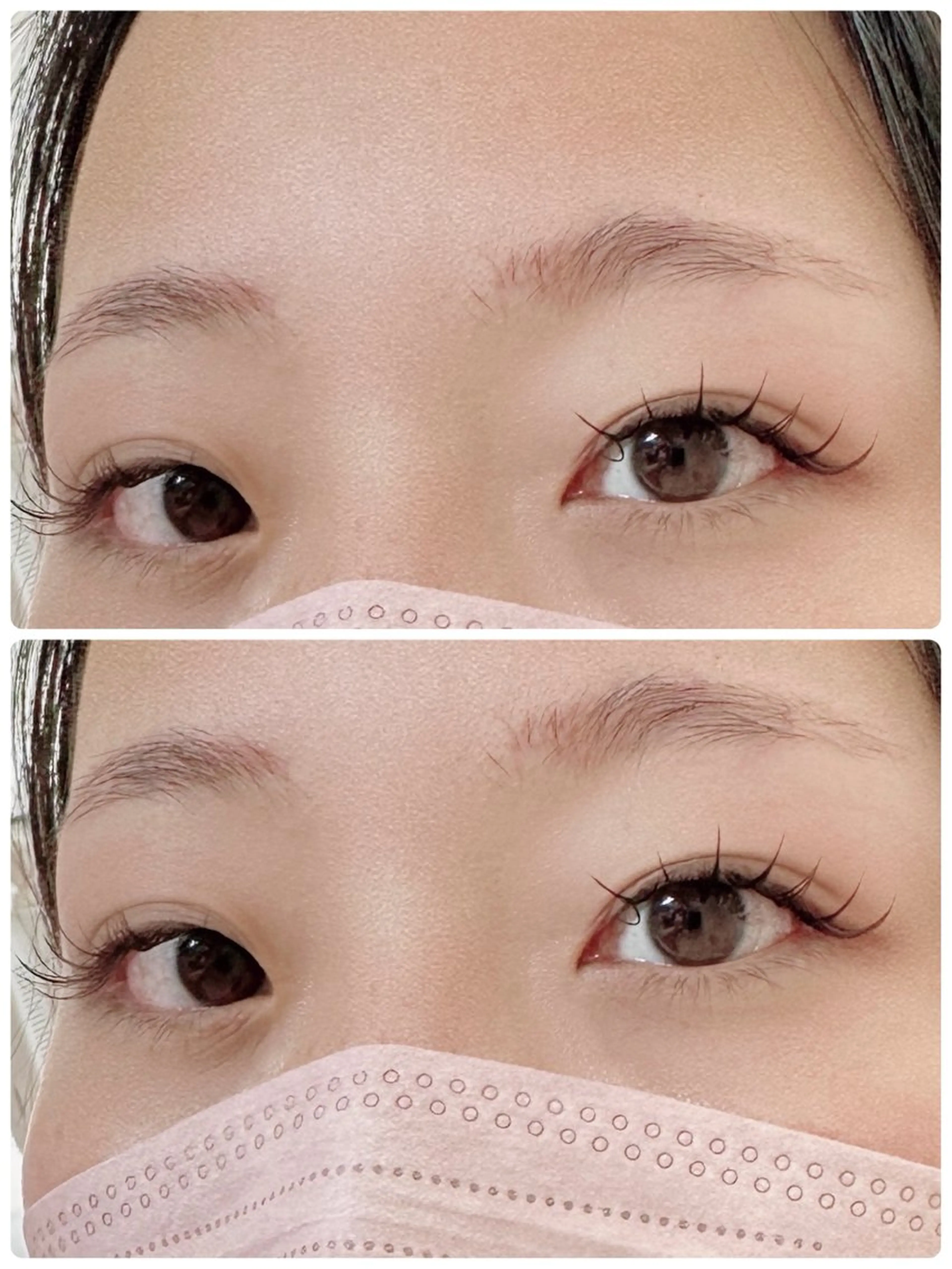 バインドロック100束の写真