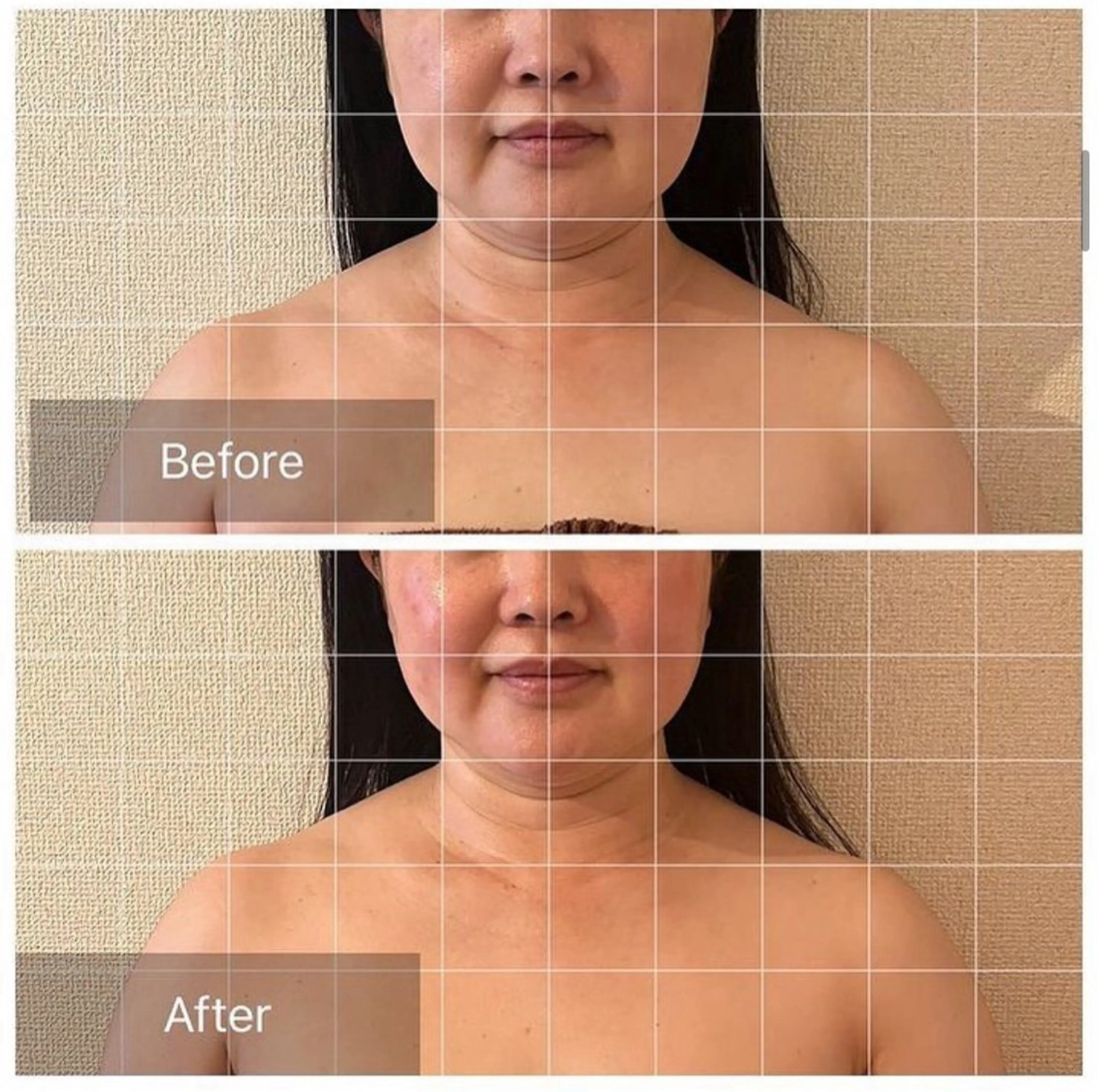 エステ リラク 表情筋フェイシャル 三軒茶屋のエステ・リラクイメージ