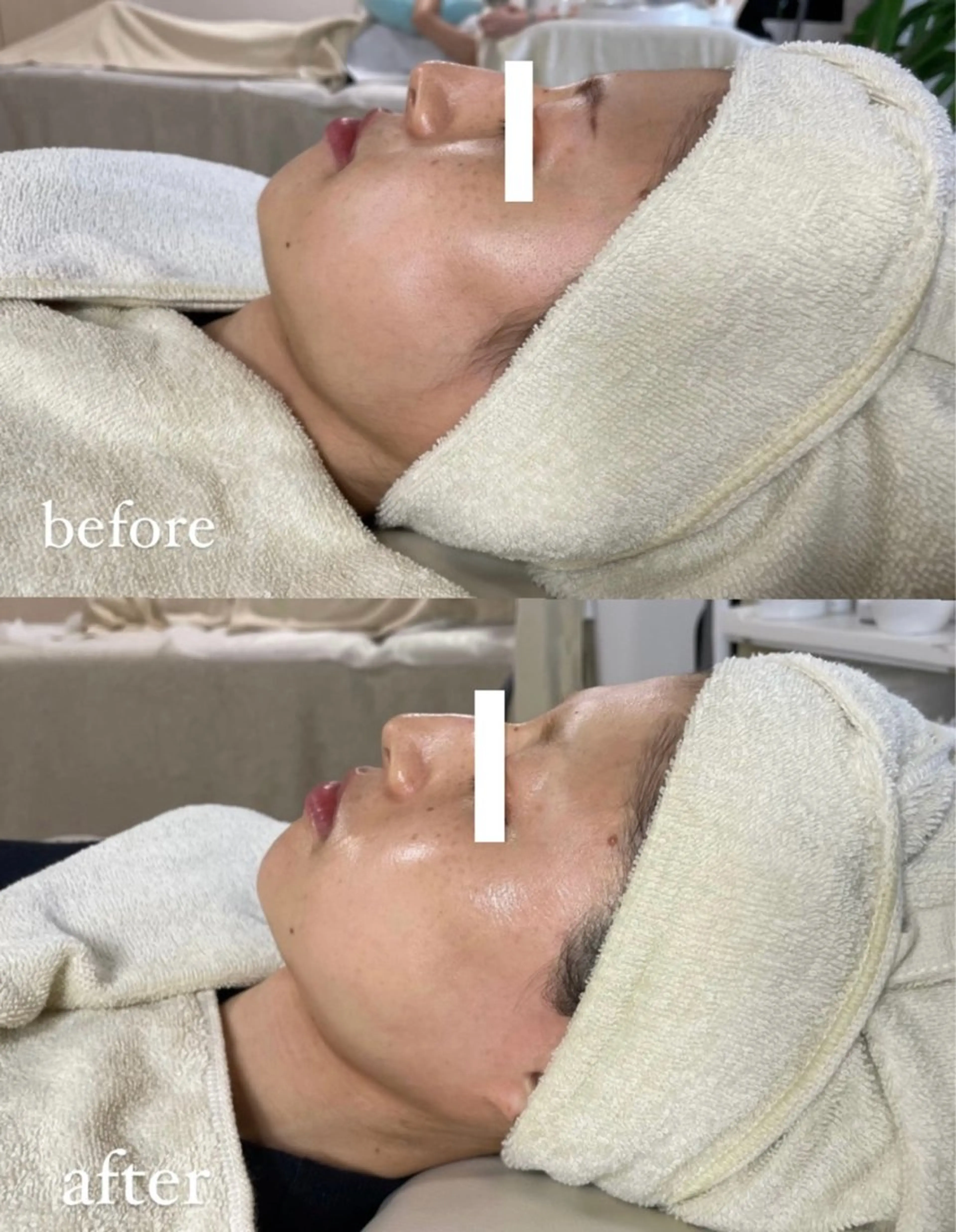 脱毛 エステサロン Mi-mi.iのエステ・リラクイメージ