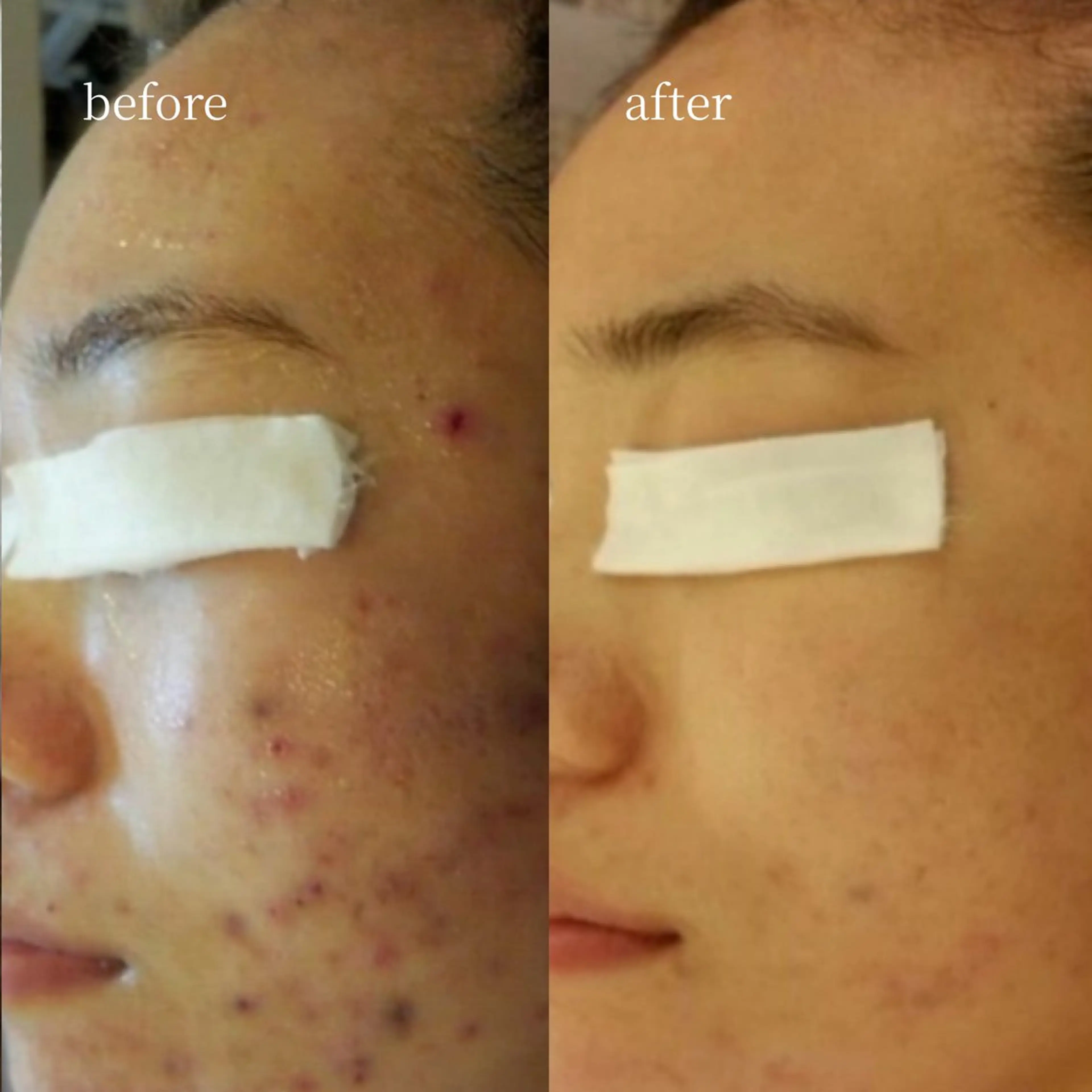 韓国肌管理・肌質改善 EARNEST心斎橋のエステ・リラクイメージ