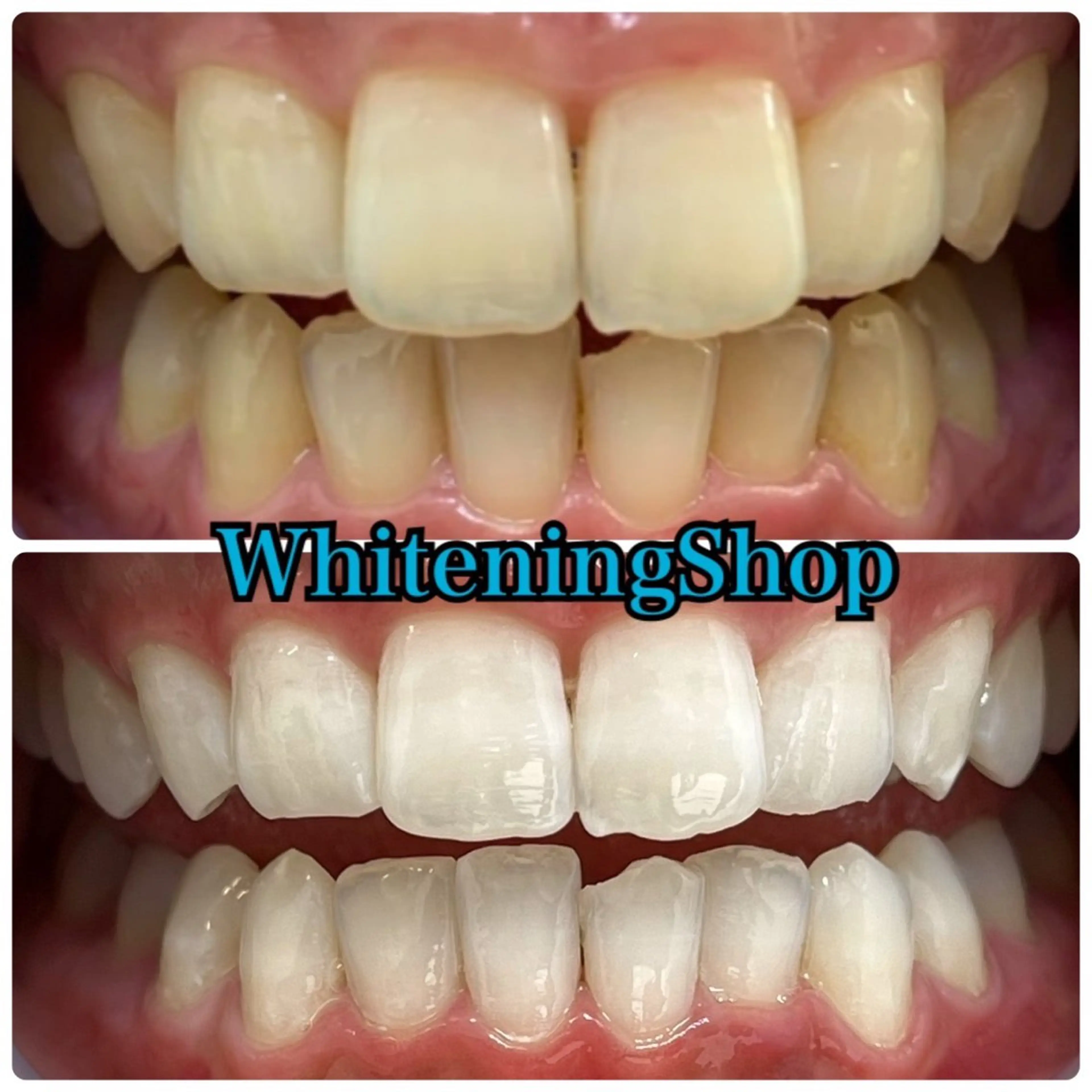 エステ リラク ホワイトニング ショップ吉祥寺店のエステ・リラクイメージ