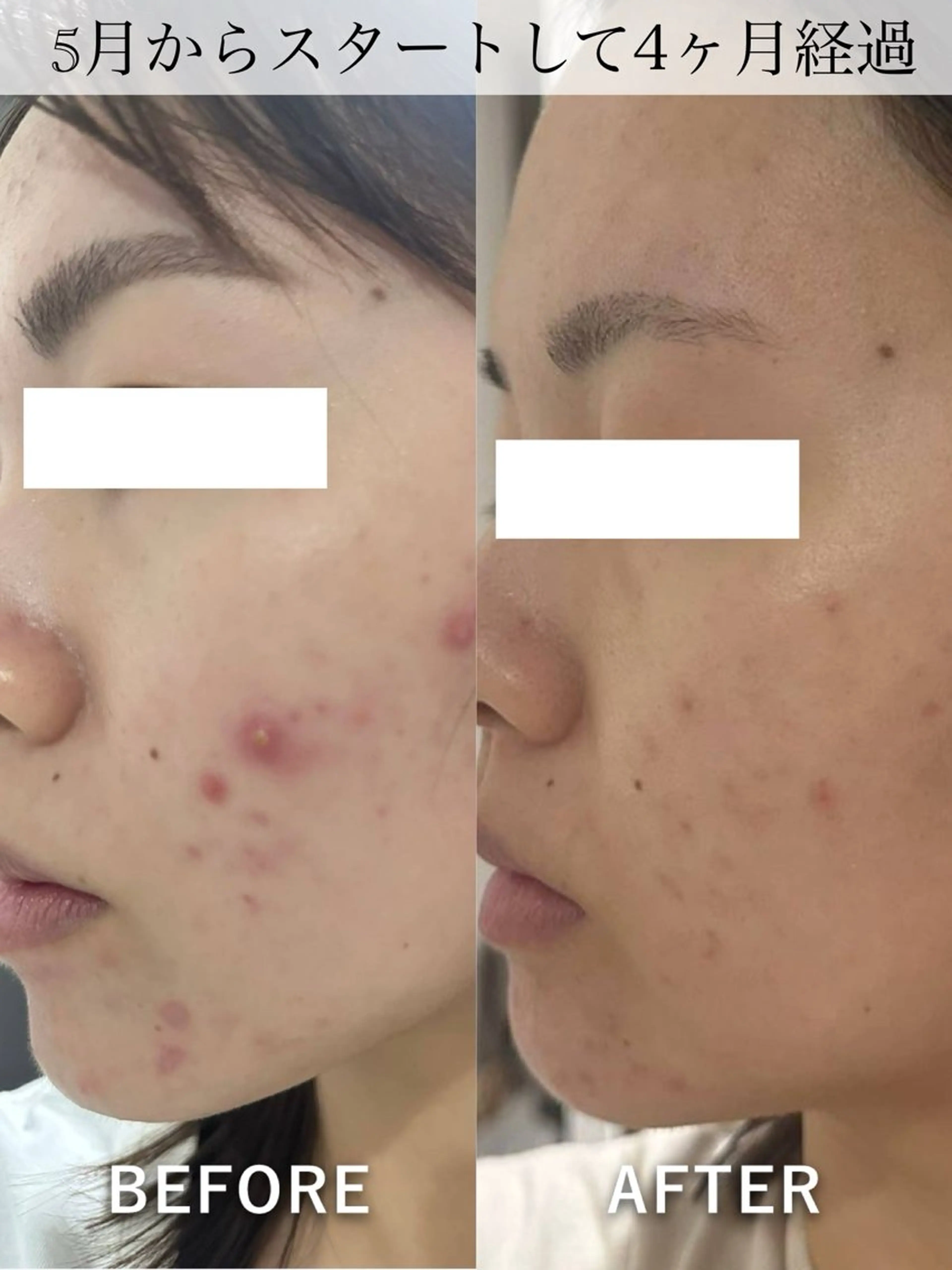 堀江リンパマッサージ 肩こり/リンパ/小顔のエステ・リラクイメージ