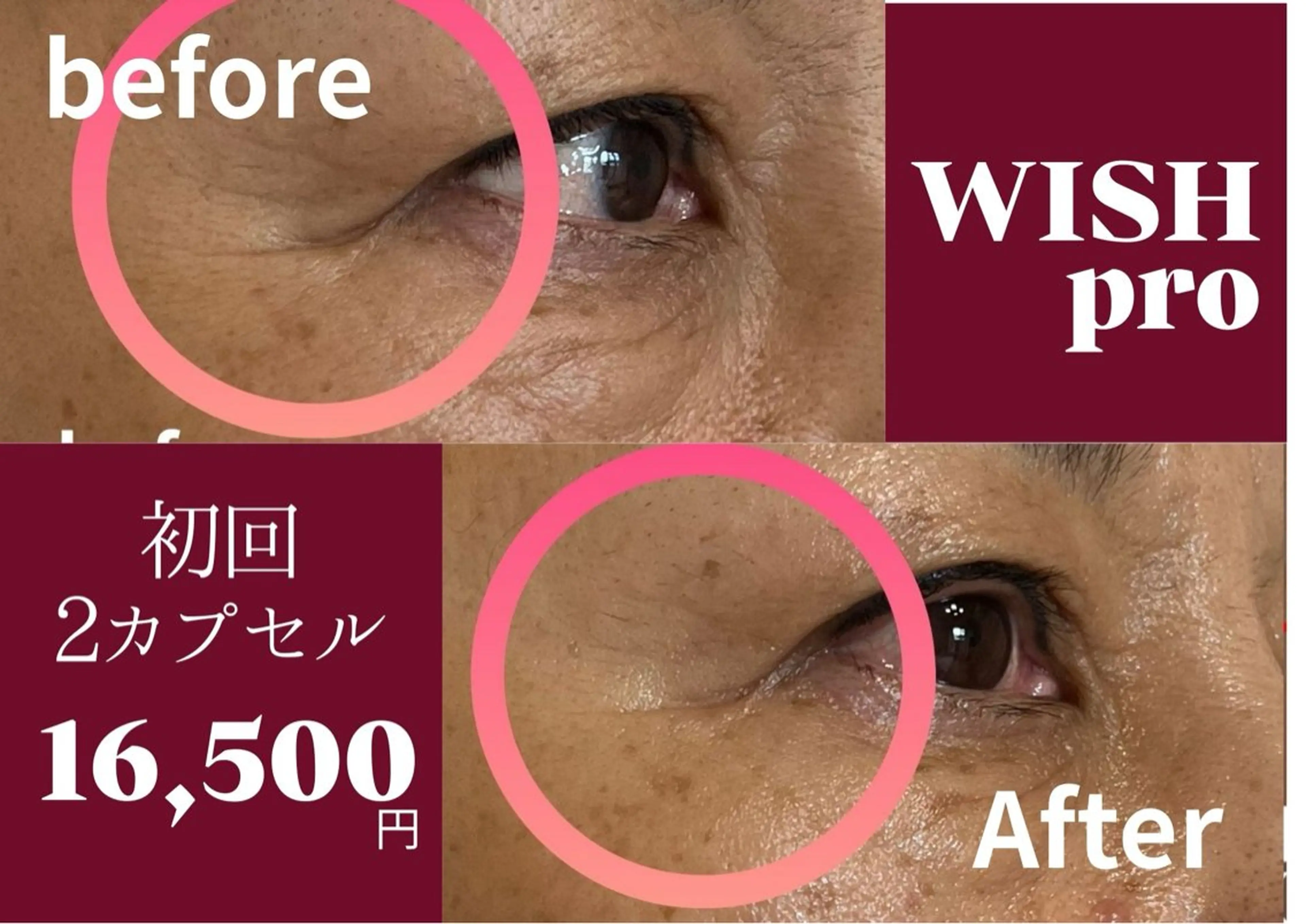 脱毛専門 ページ/Bloomのエステ・リラクイメージ