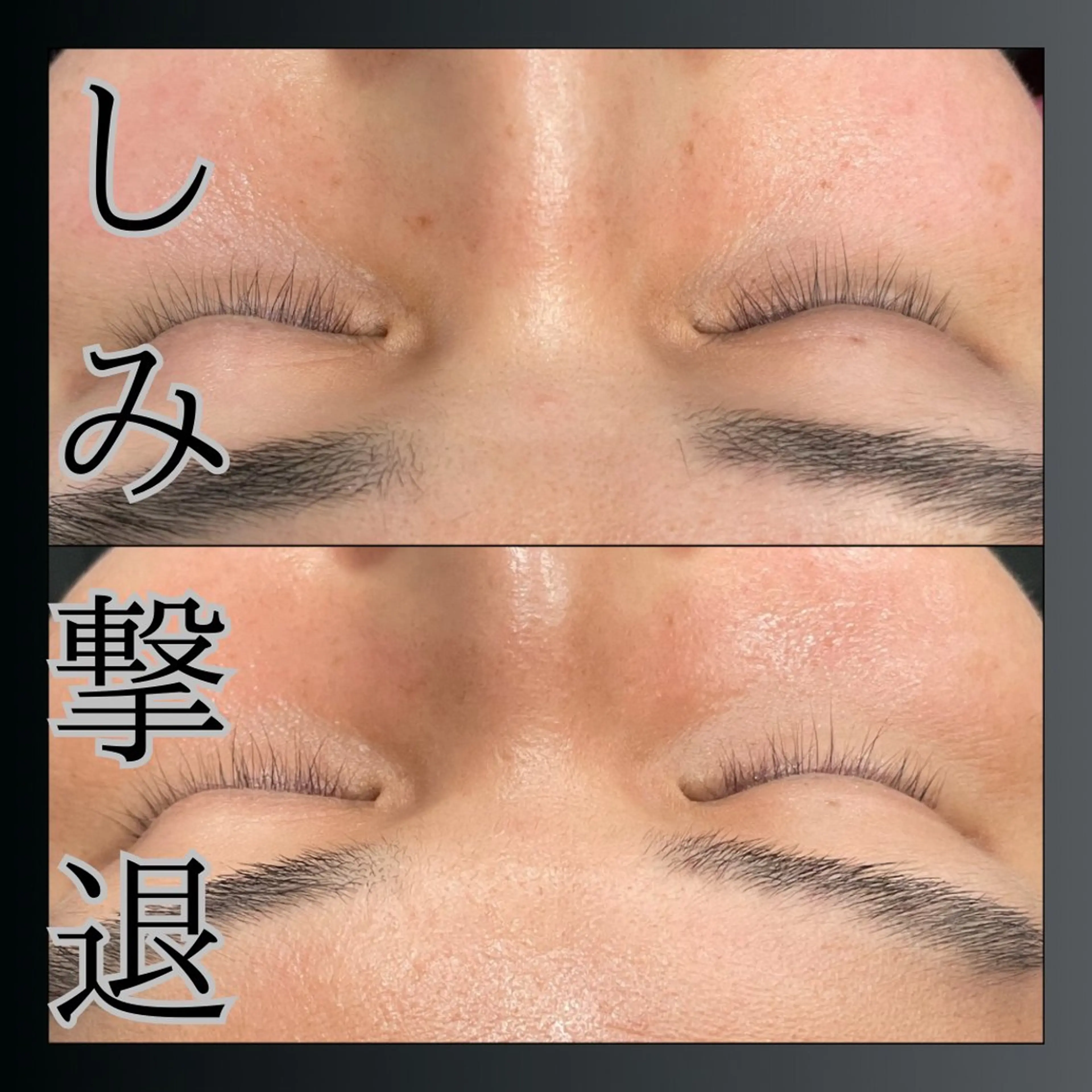 エステ LiZA エステティックサロンのエステ・リラクイメージ