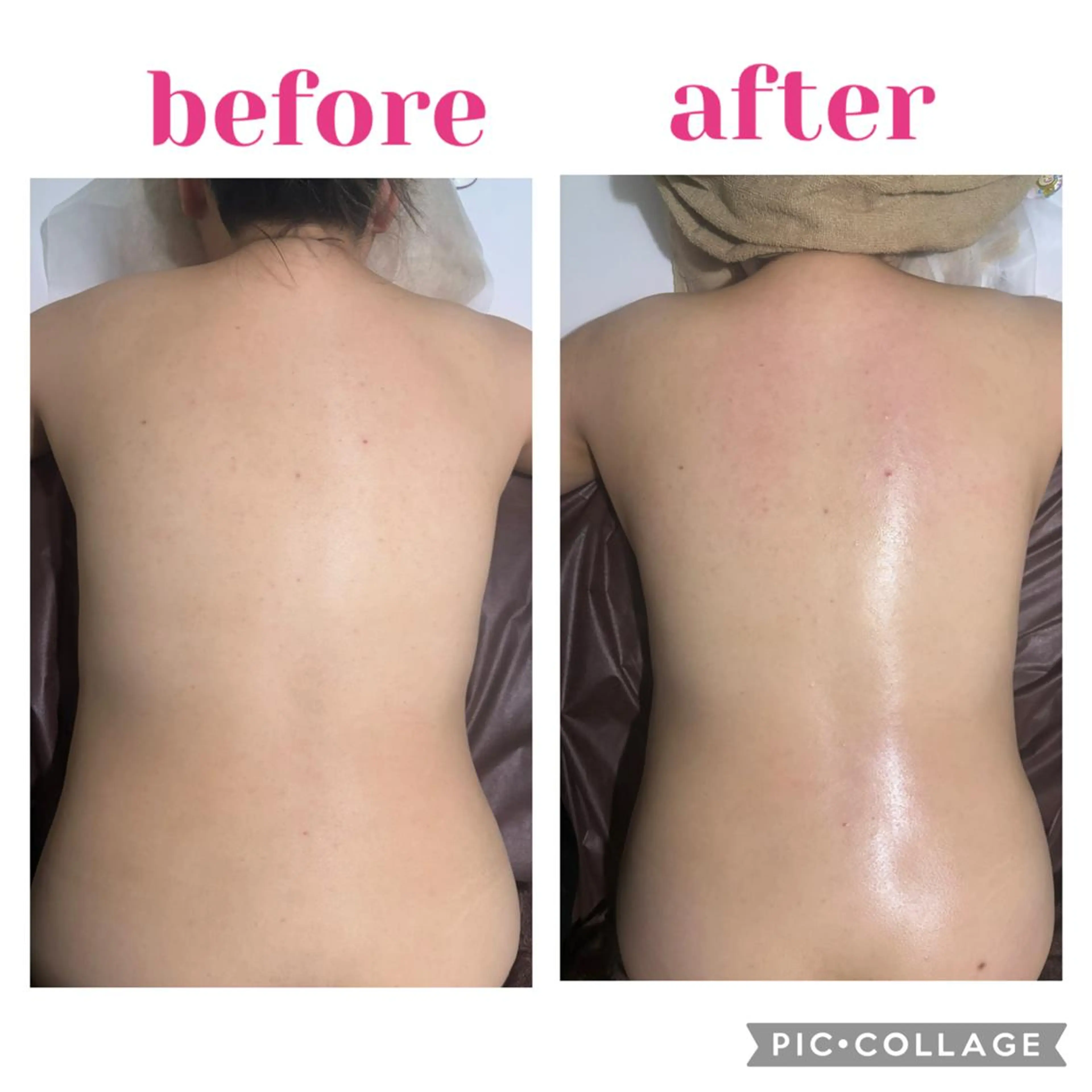 痩身リンパの写真