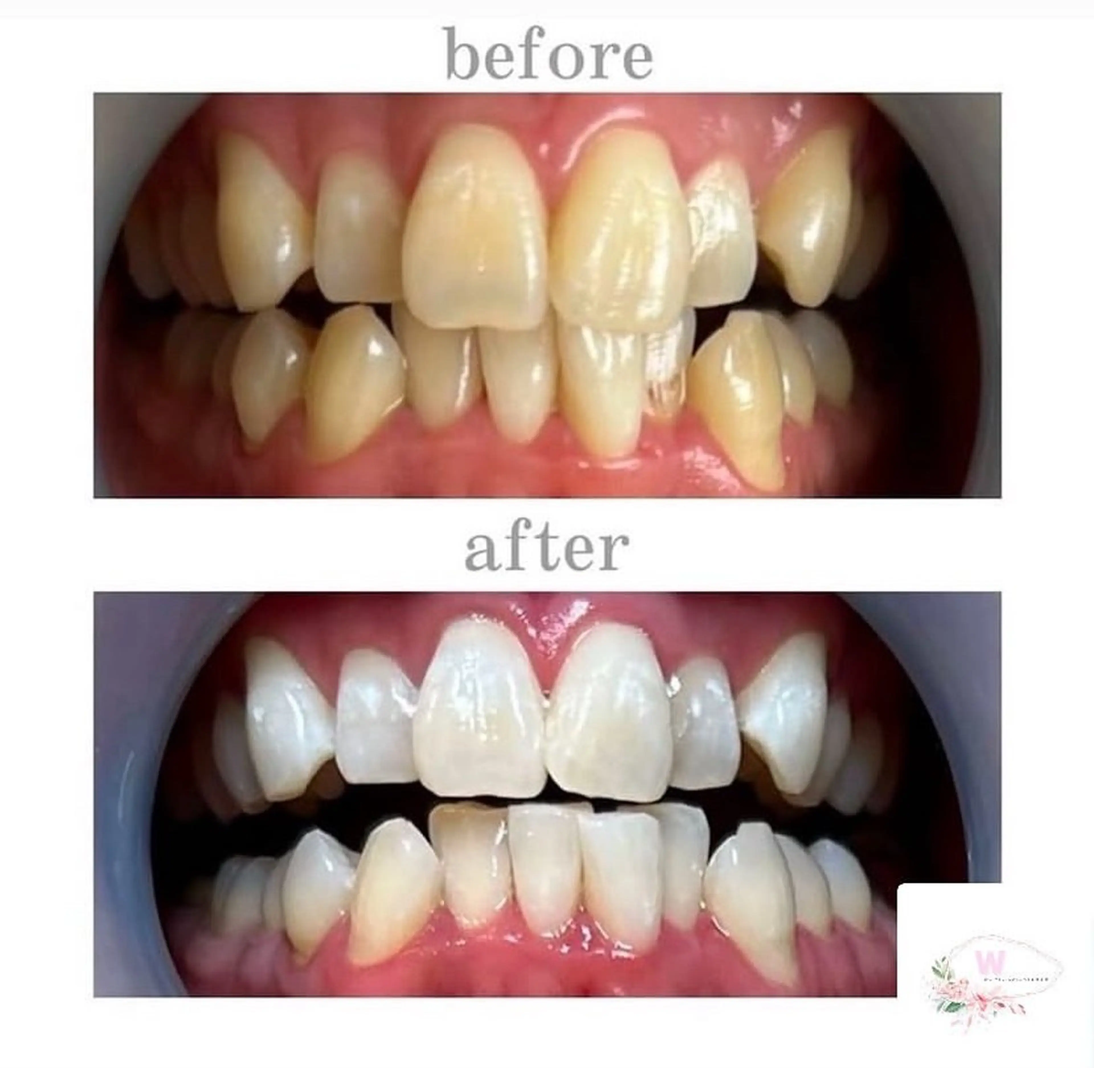 ホワイトニング ショップ本厚木のその他イメージ