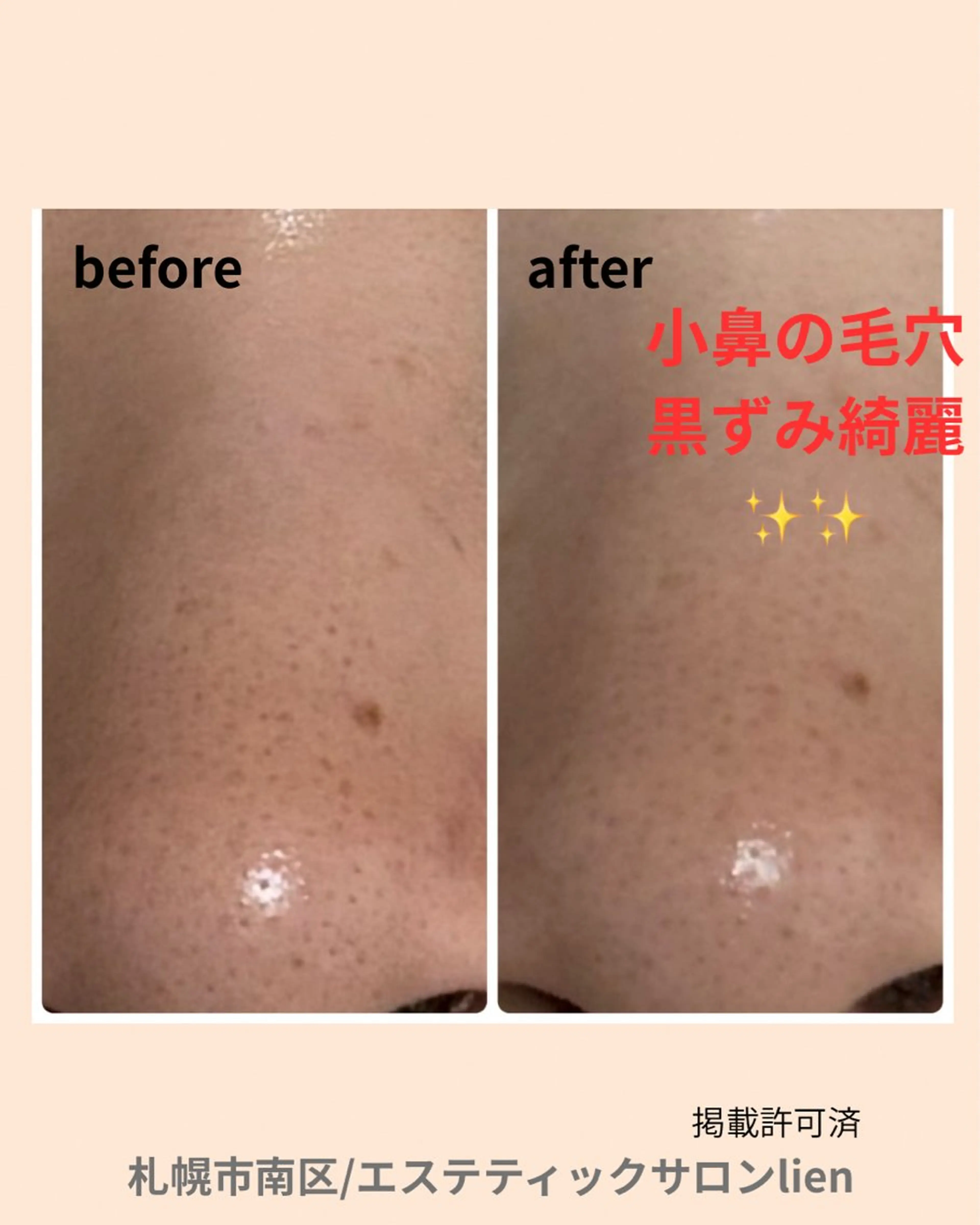 hiro_ narisのエステ・リラクイメージ