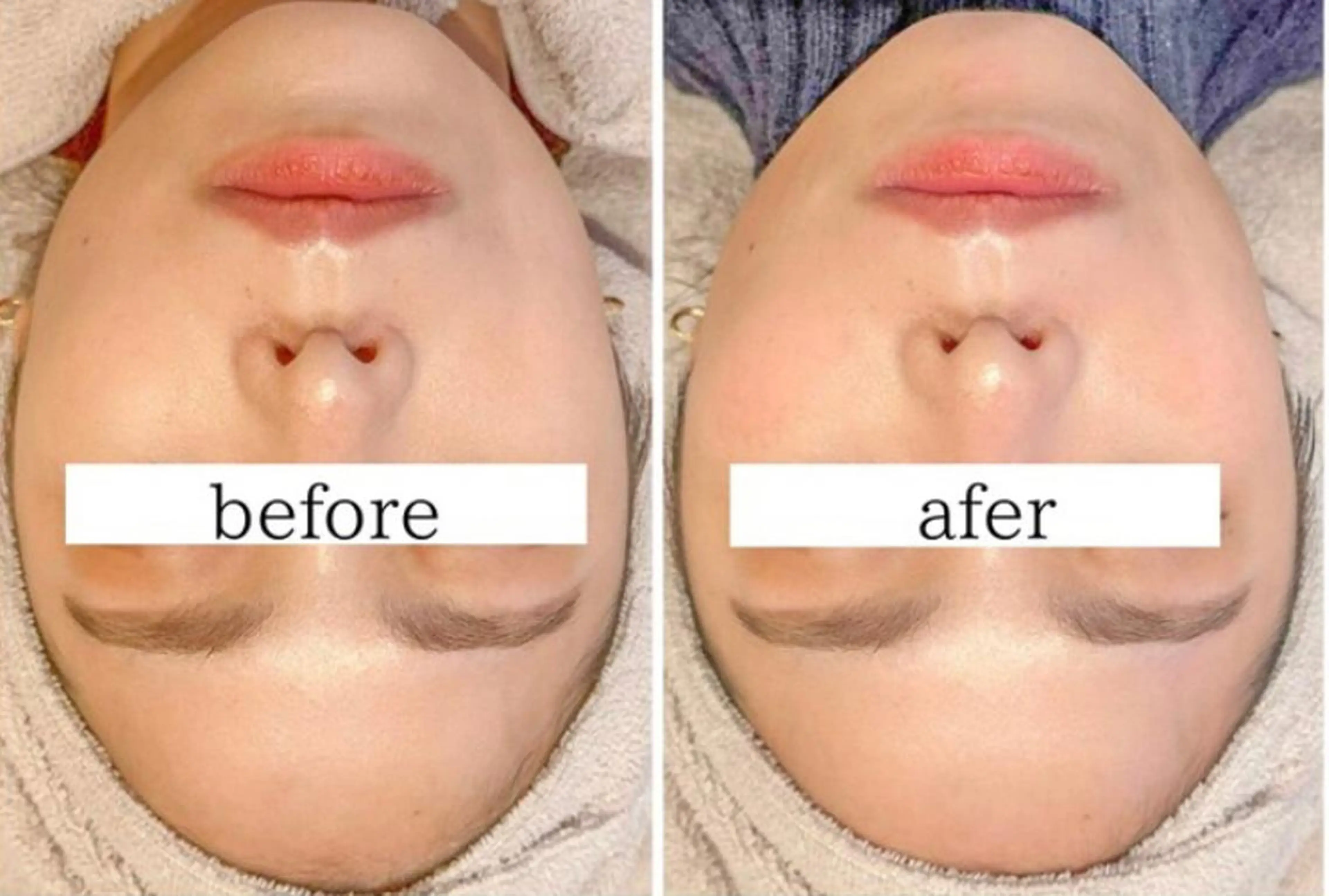 エステ aliaハーブ水光店 エステティシャン募集のエステ・リラクイメージ