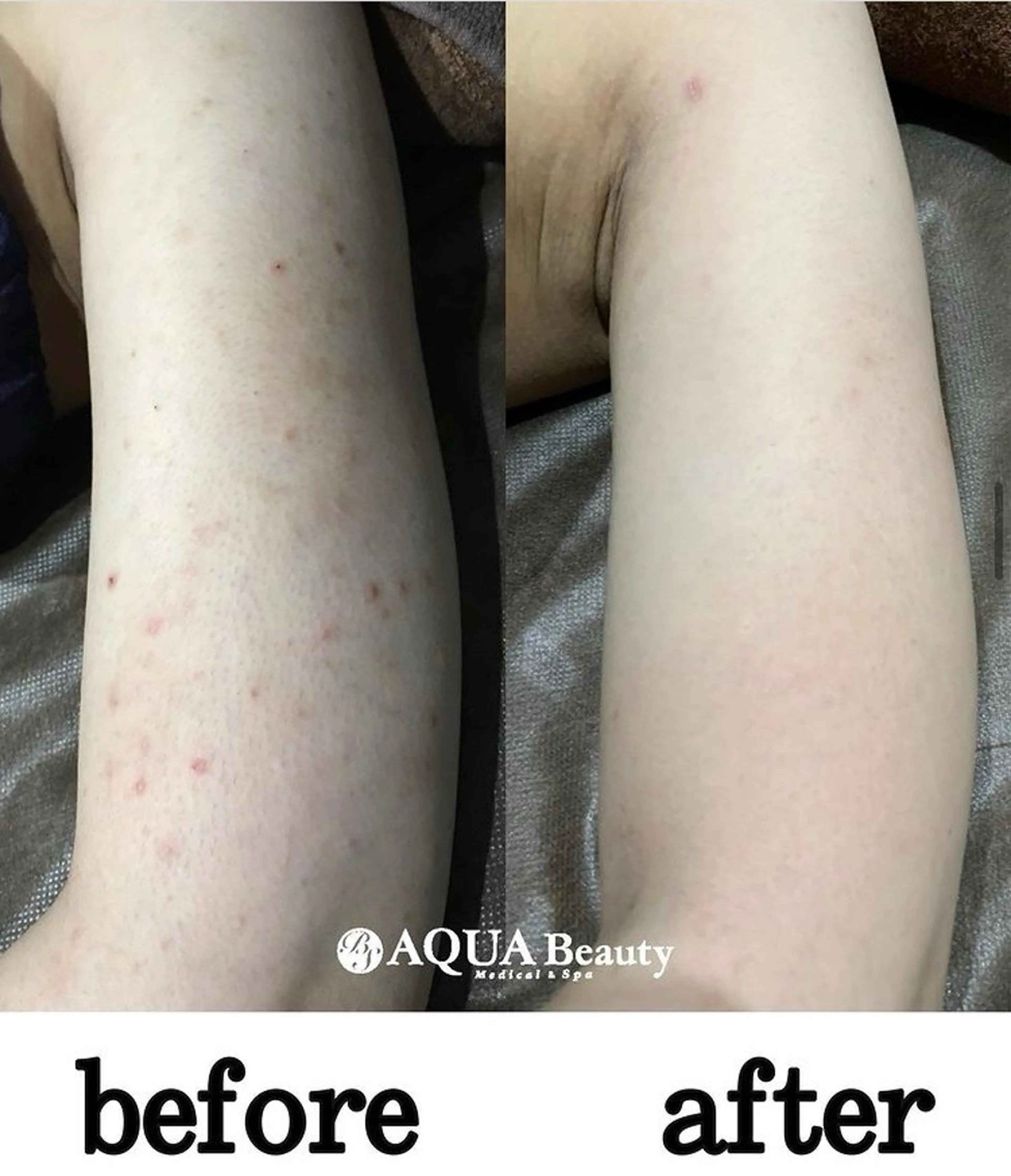 エステ BS AQUA 岡田のエステ・リラクイメージ