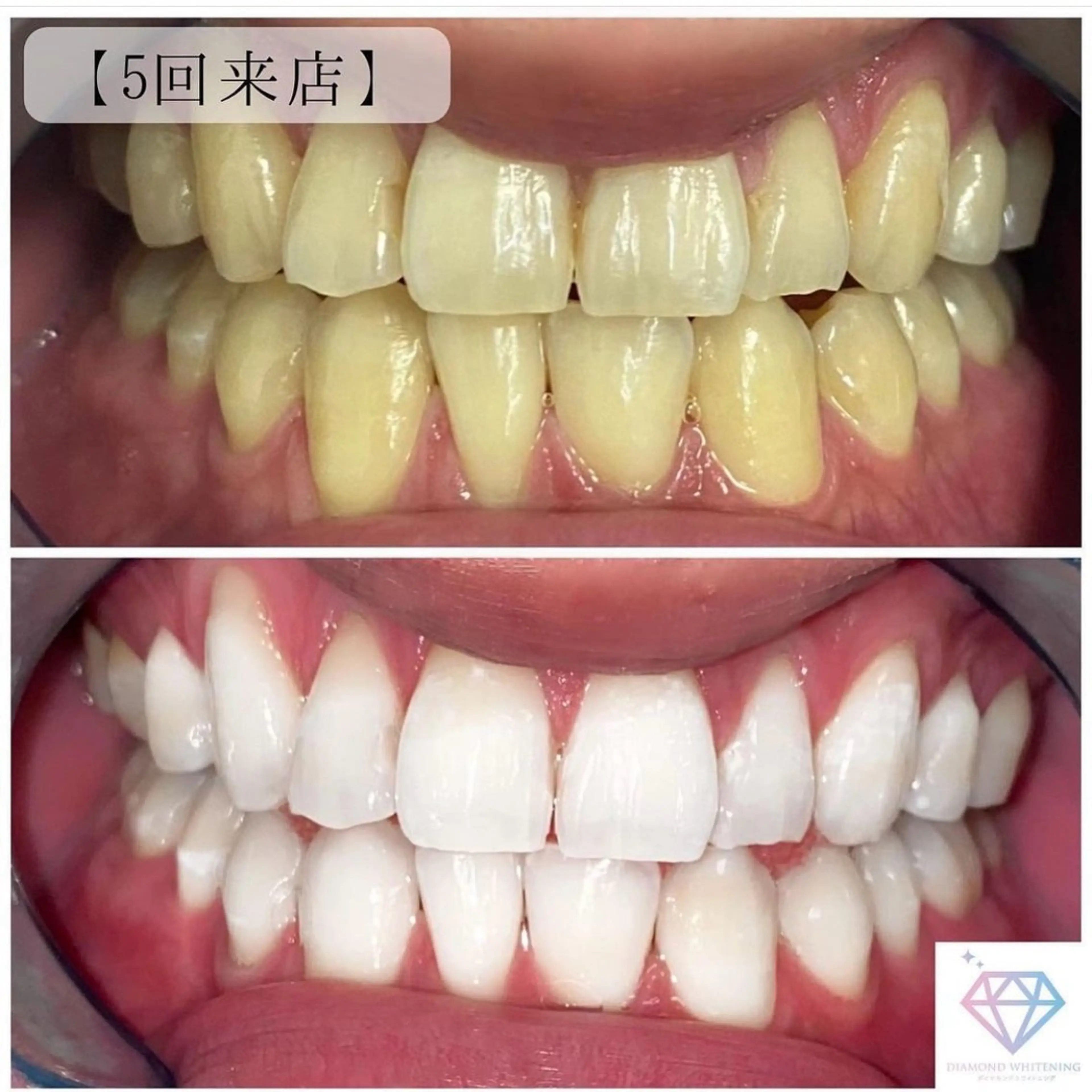 DIAMOND BEAUYのその他イメージ