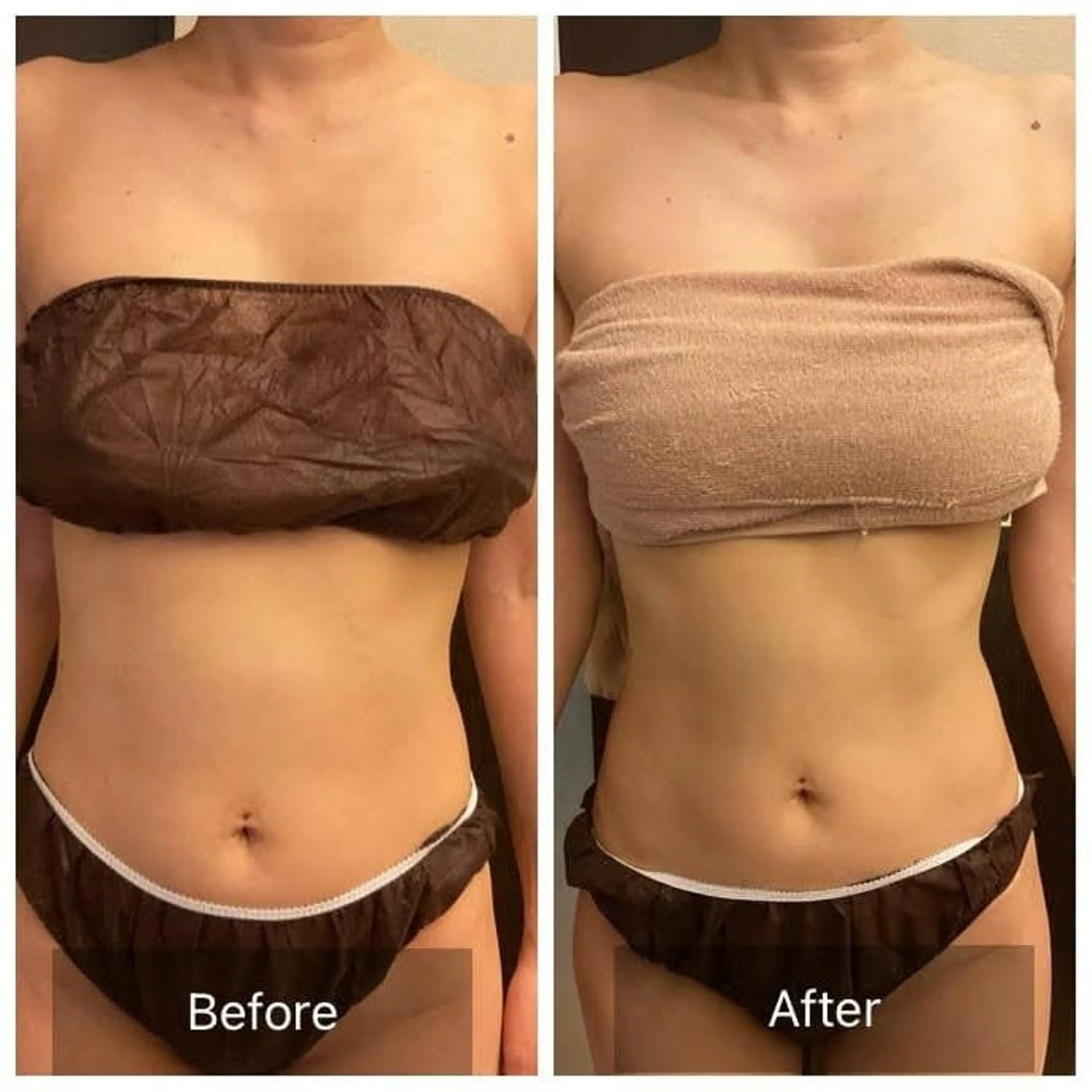 人気No1✨スピード痩身♪ マシン3台使用がっつり痩せ150分53900円→26800円の写真