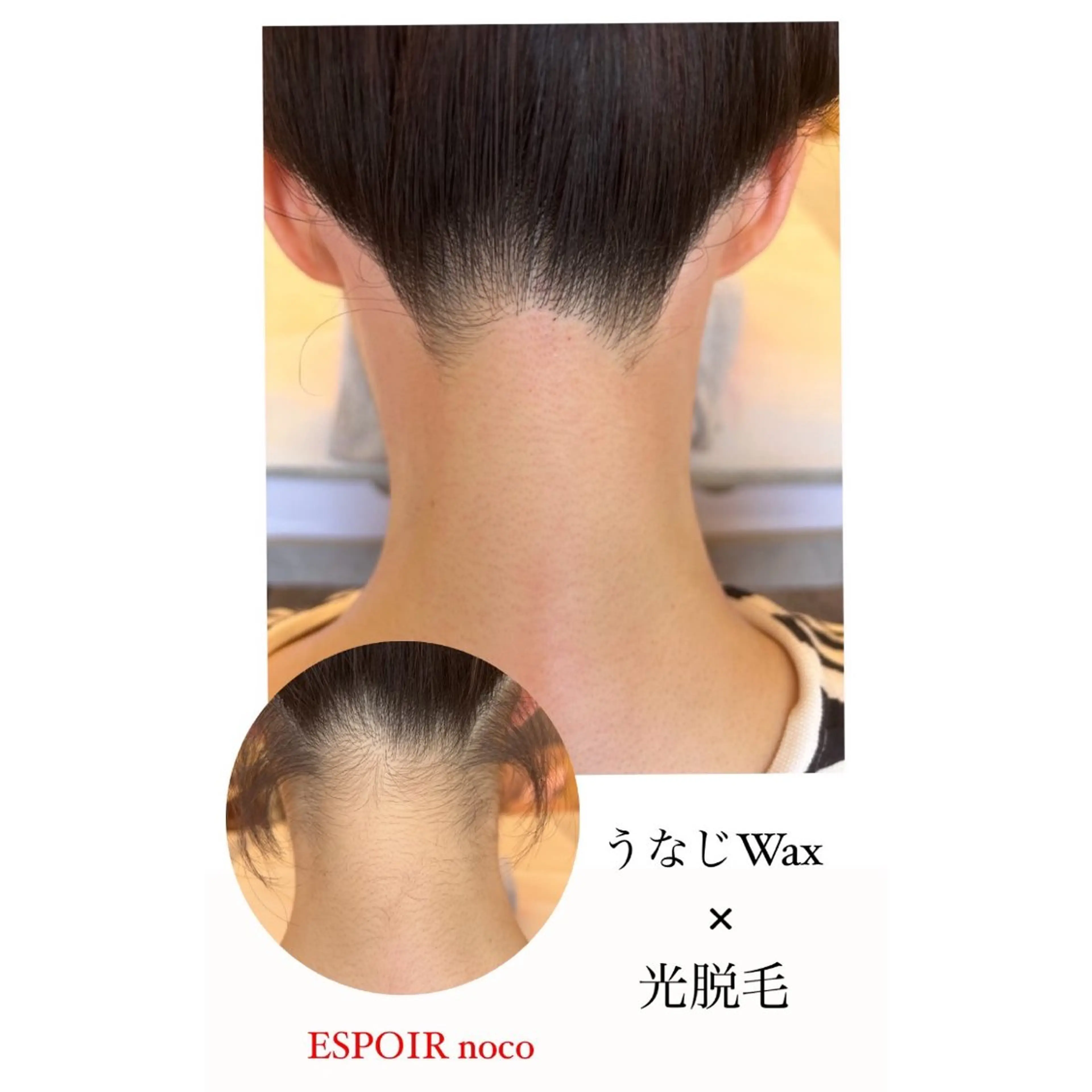 ワックス脱毛🌈 ESPOIRnocoのエステ・リラクイメージ
