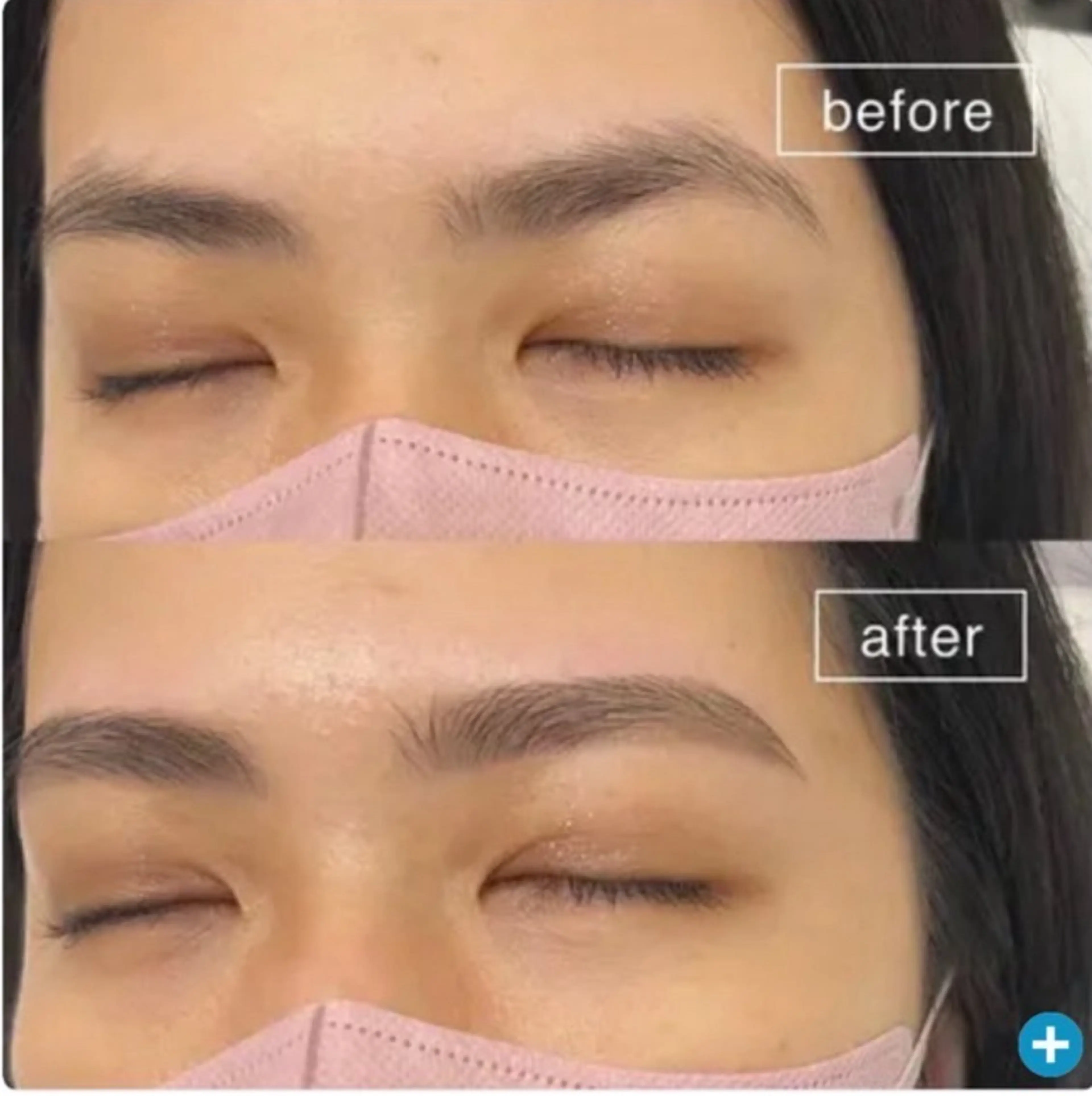 ワックス脱毛の写真