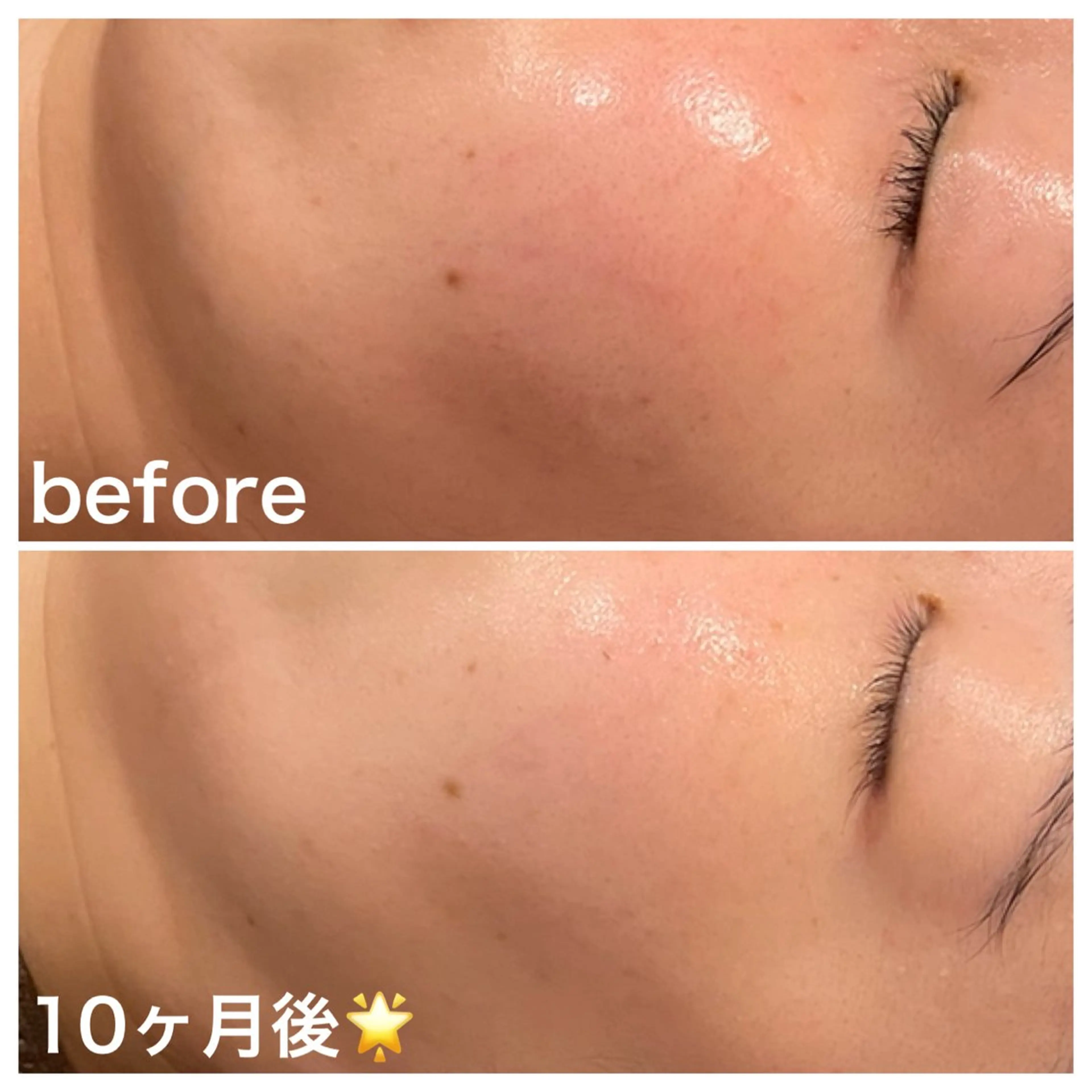 エステ リラク 浜野 恵美のエステ・リラクイメージ