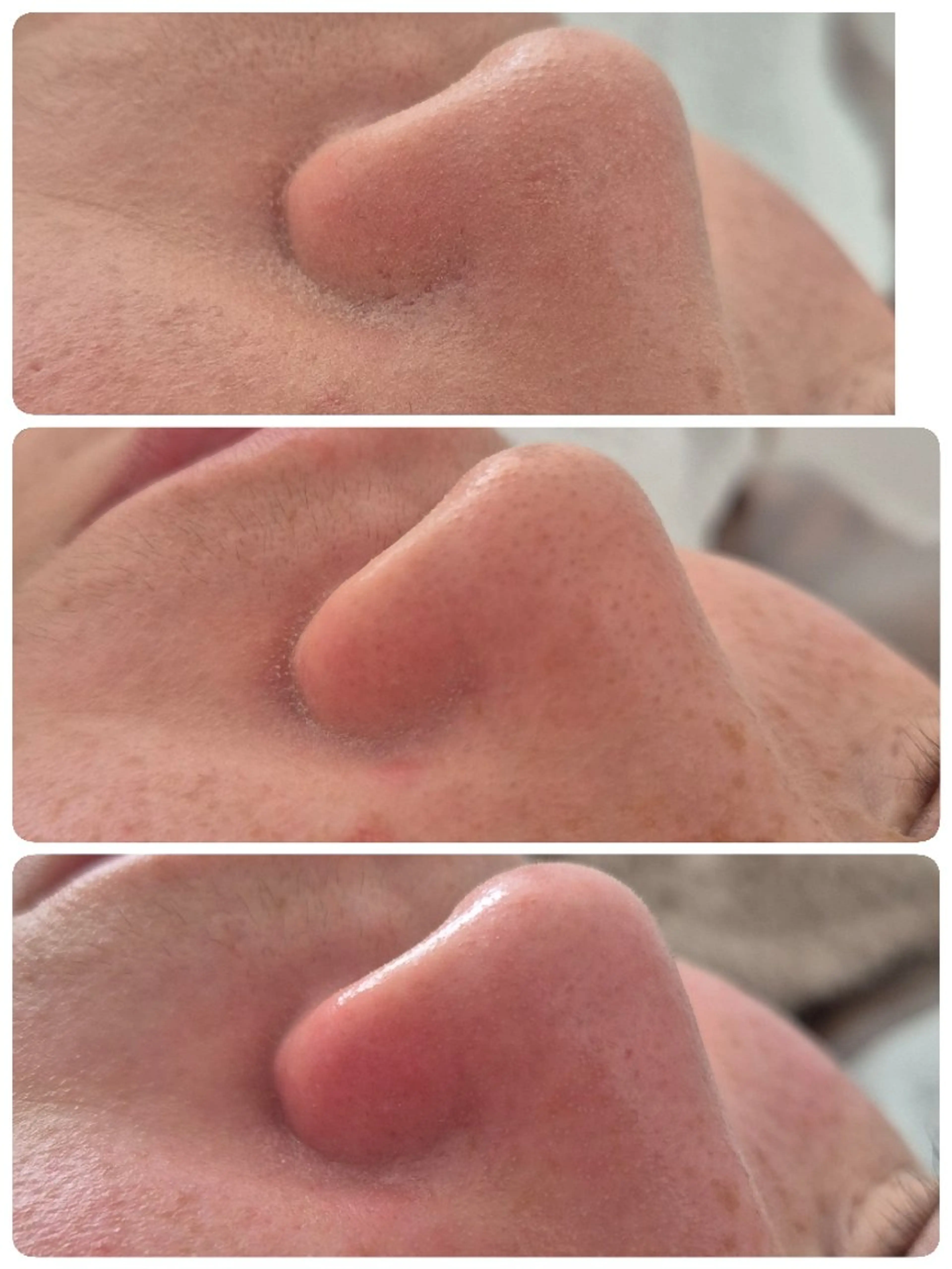 エステ REH2O Rihoのエステ・リラクイメージ