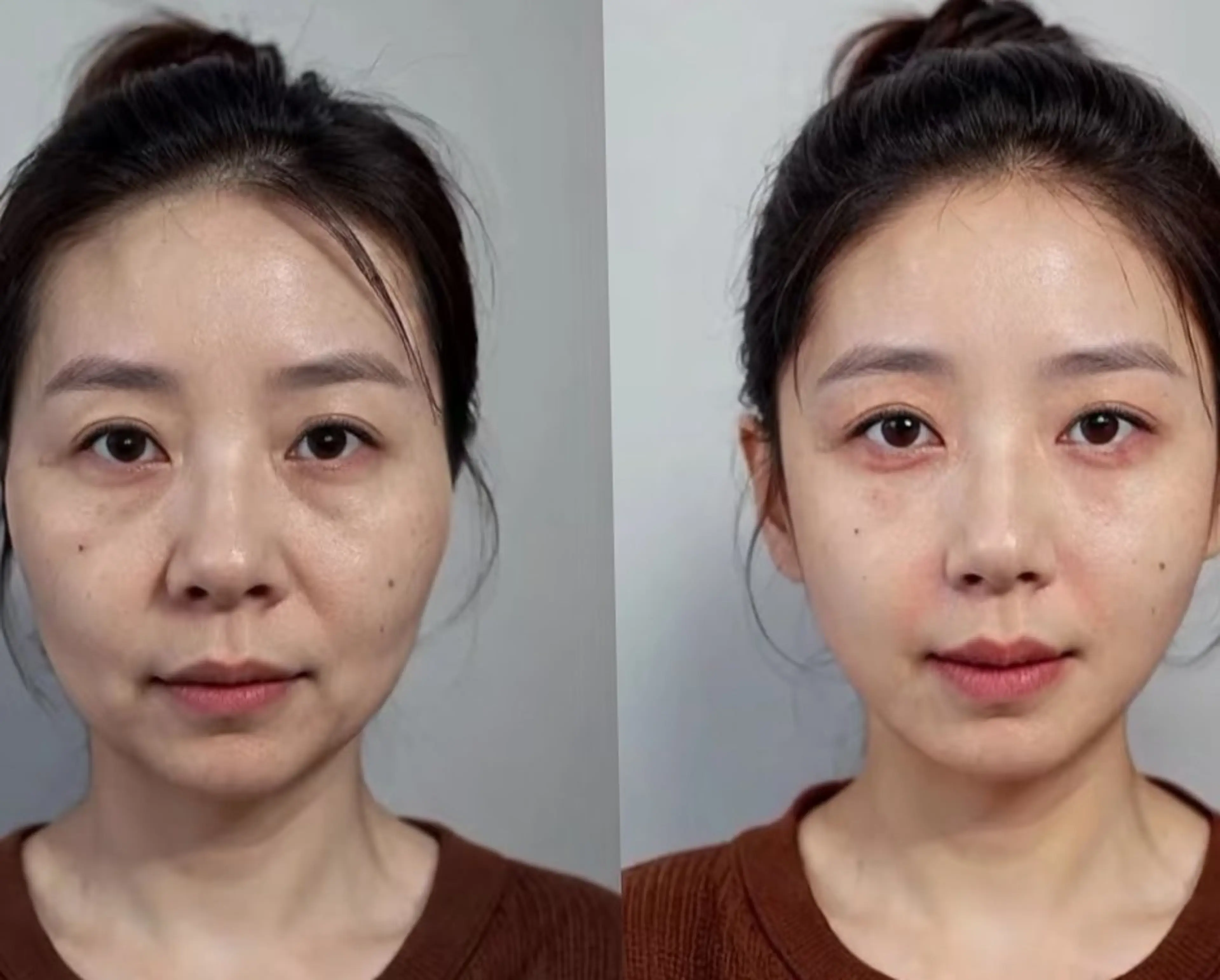 aliaハーブ水光店 エステティシャン募集のエステ・リラクイメージ