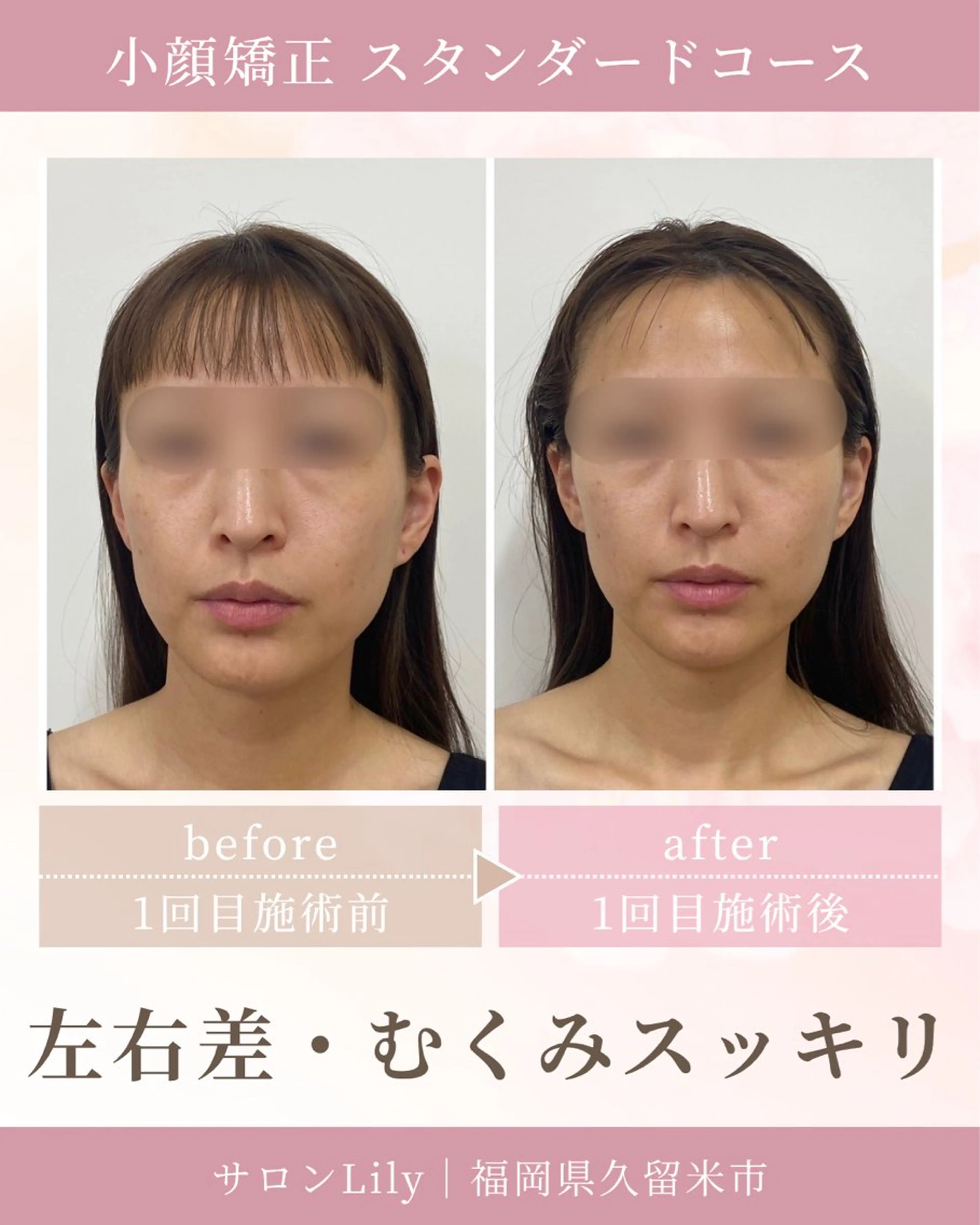 小顔矯正サロン Lilyのエステ・リラクイメージ