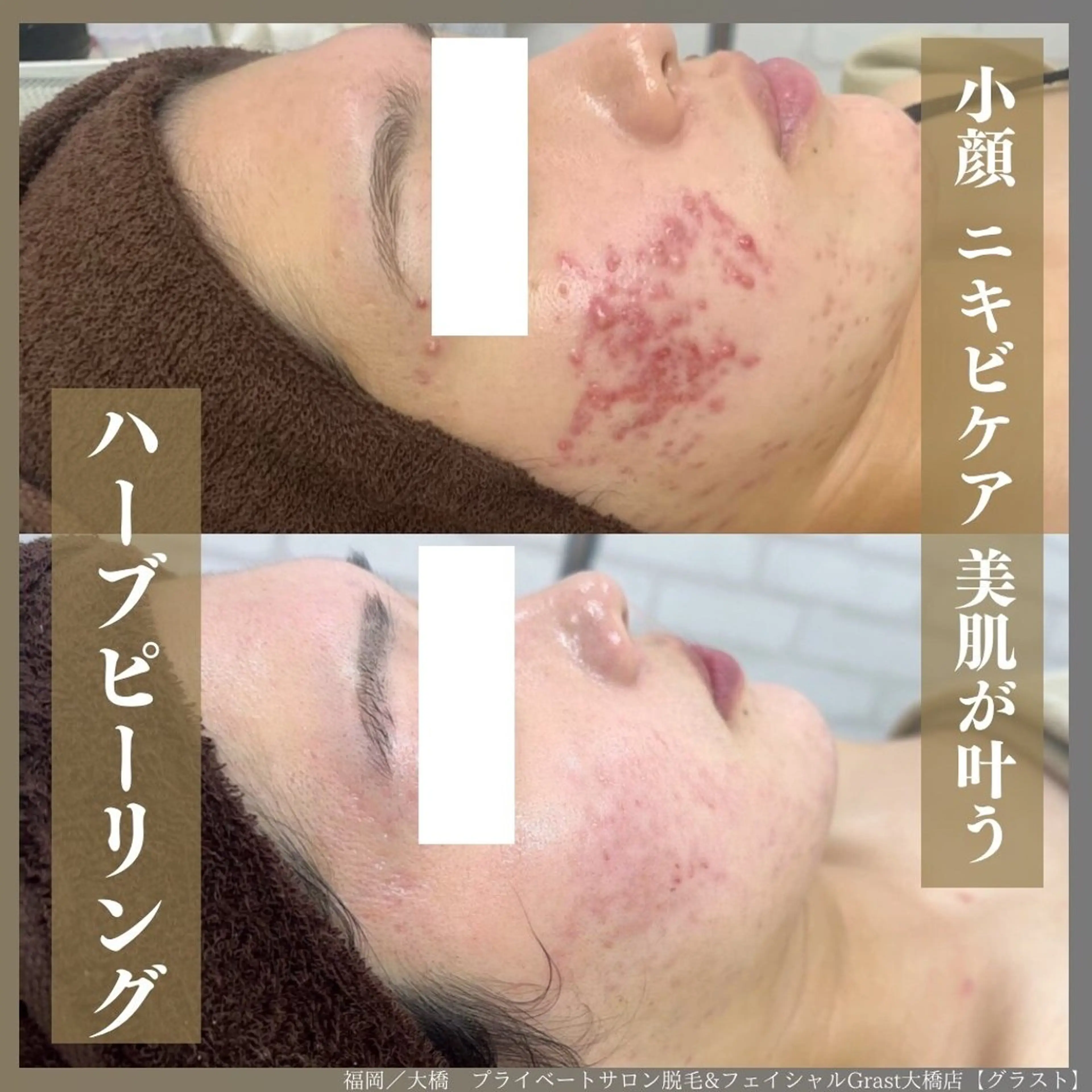 ツヤ肌脱毛サロン Grast🌿アイカのエステ・リラクイメージ