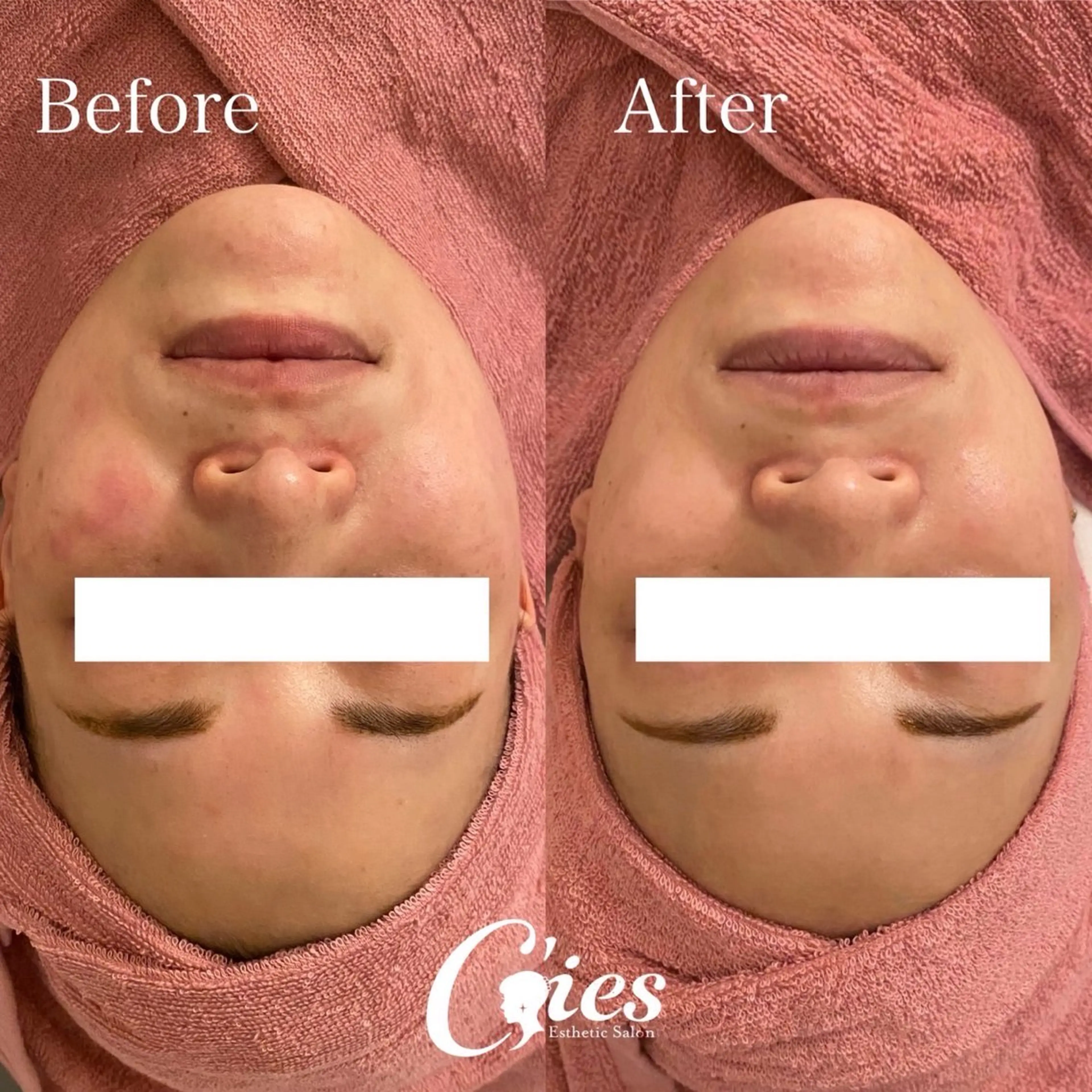 C'ies Esthetic Salon所属・CHIAKI ♪のエステ・リラクイメージ