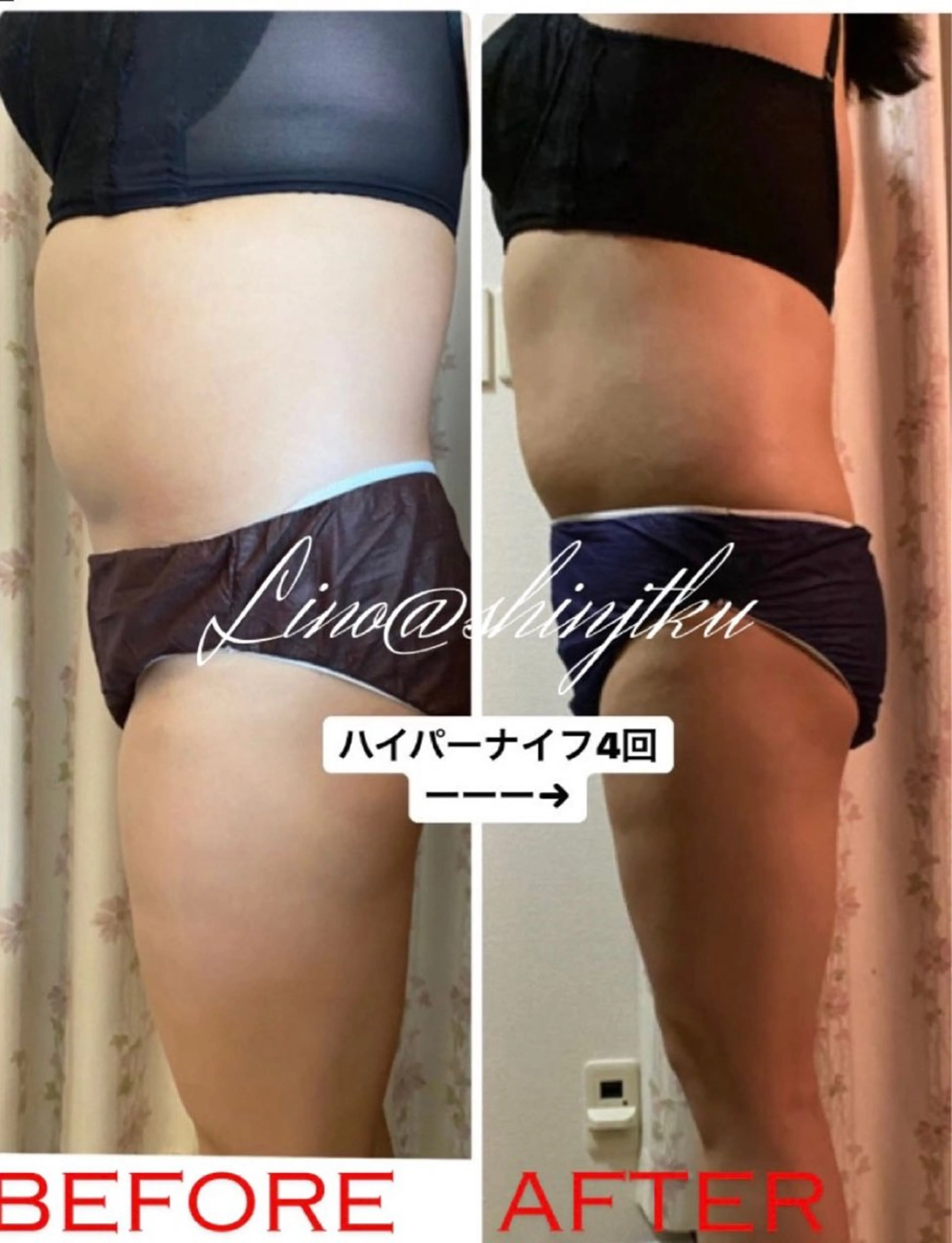 リラクゼーション ルナのエステ・リラクイメージ