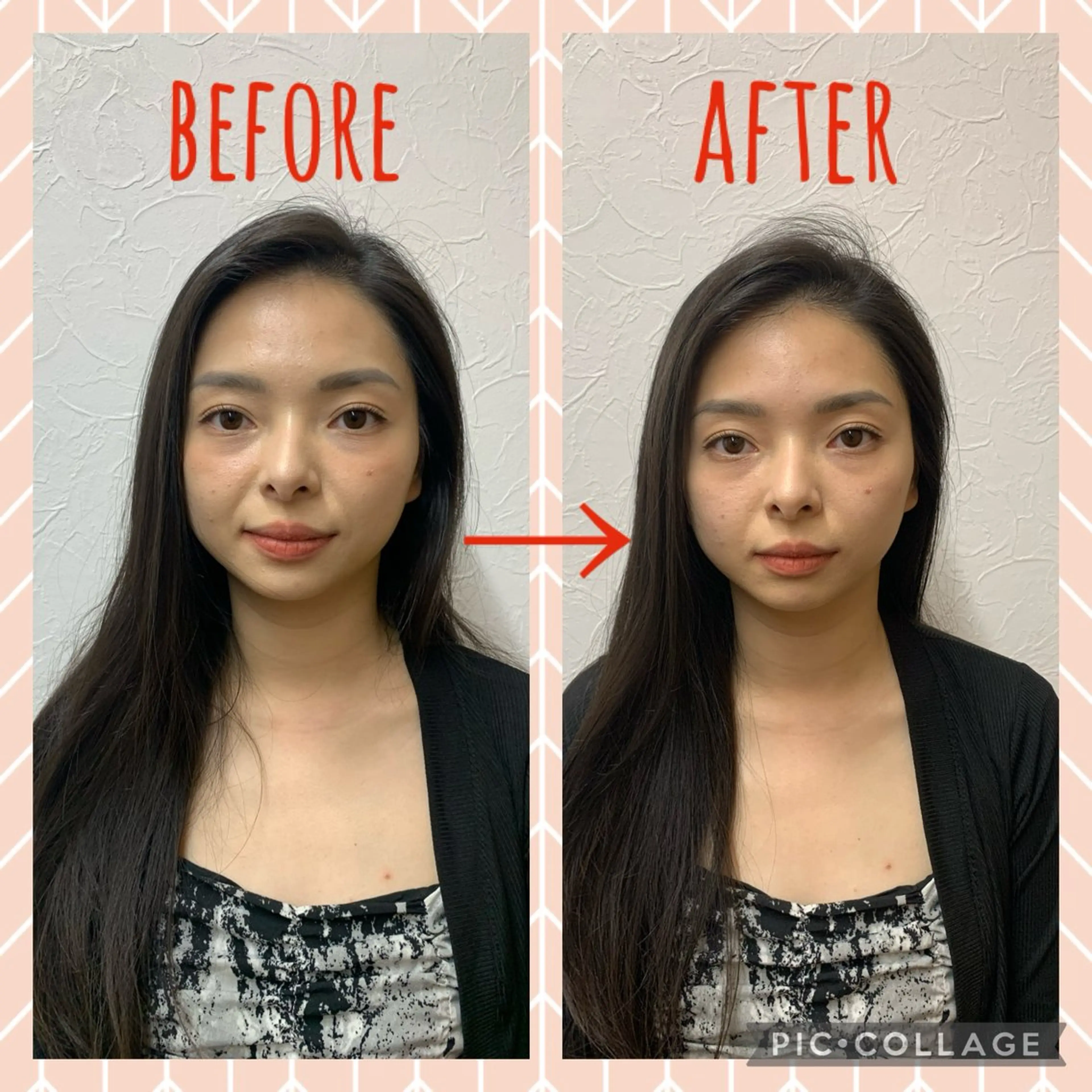 NO.10 整骨院のエステ・リラクイメージ