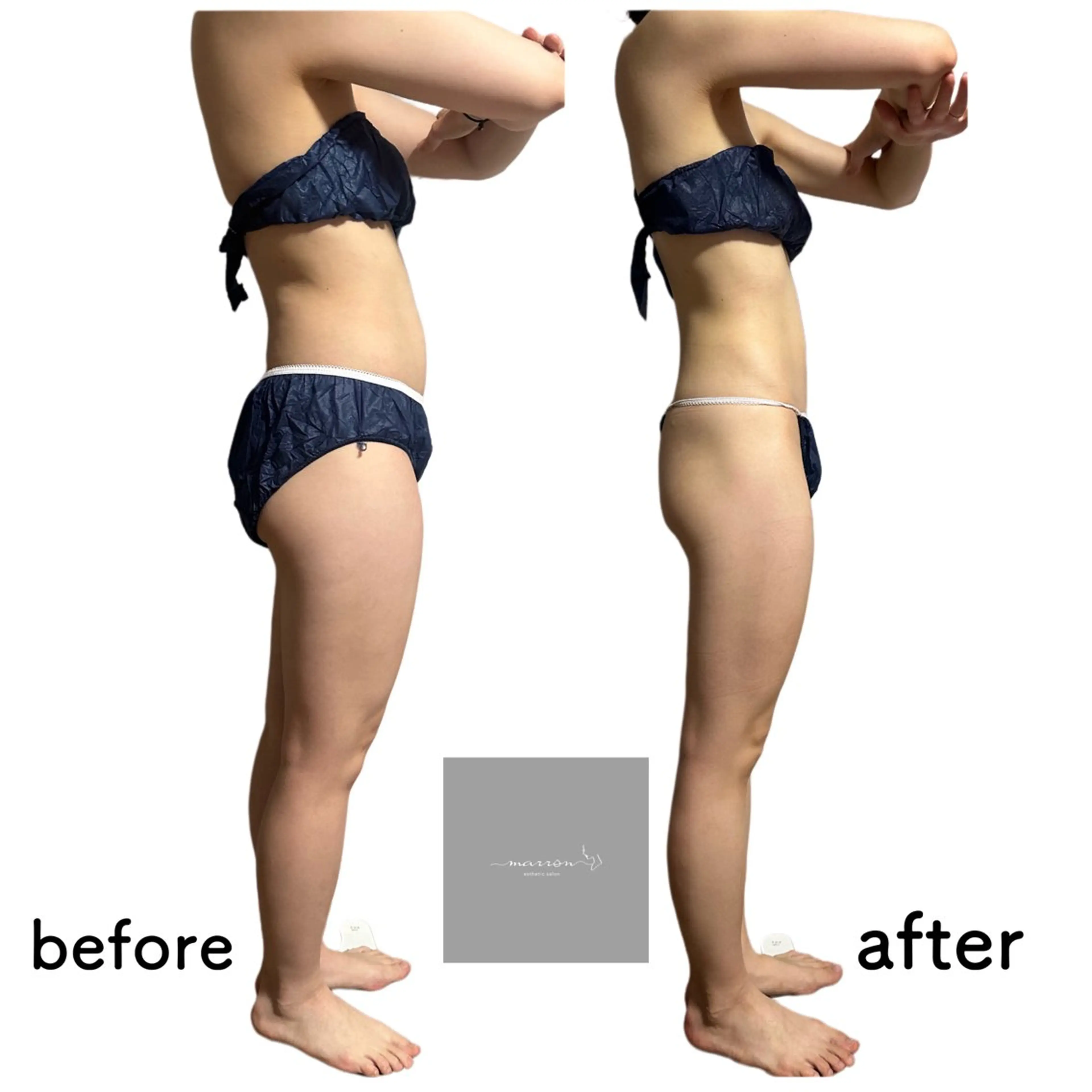 marron所属・痩身ハイパーナイフ ララピールリアボーテのエステ・リラクイメージ