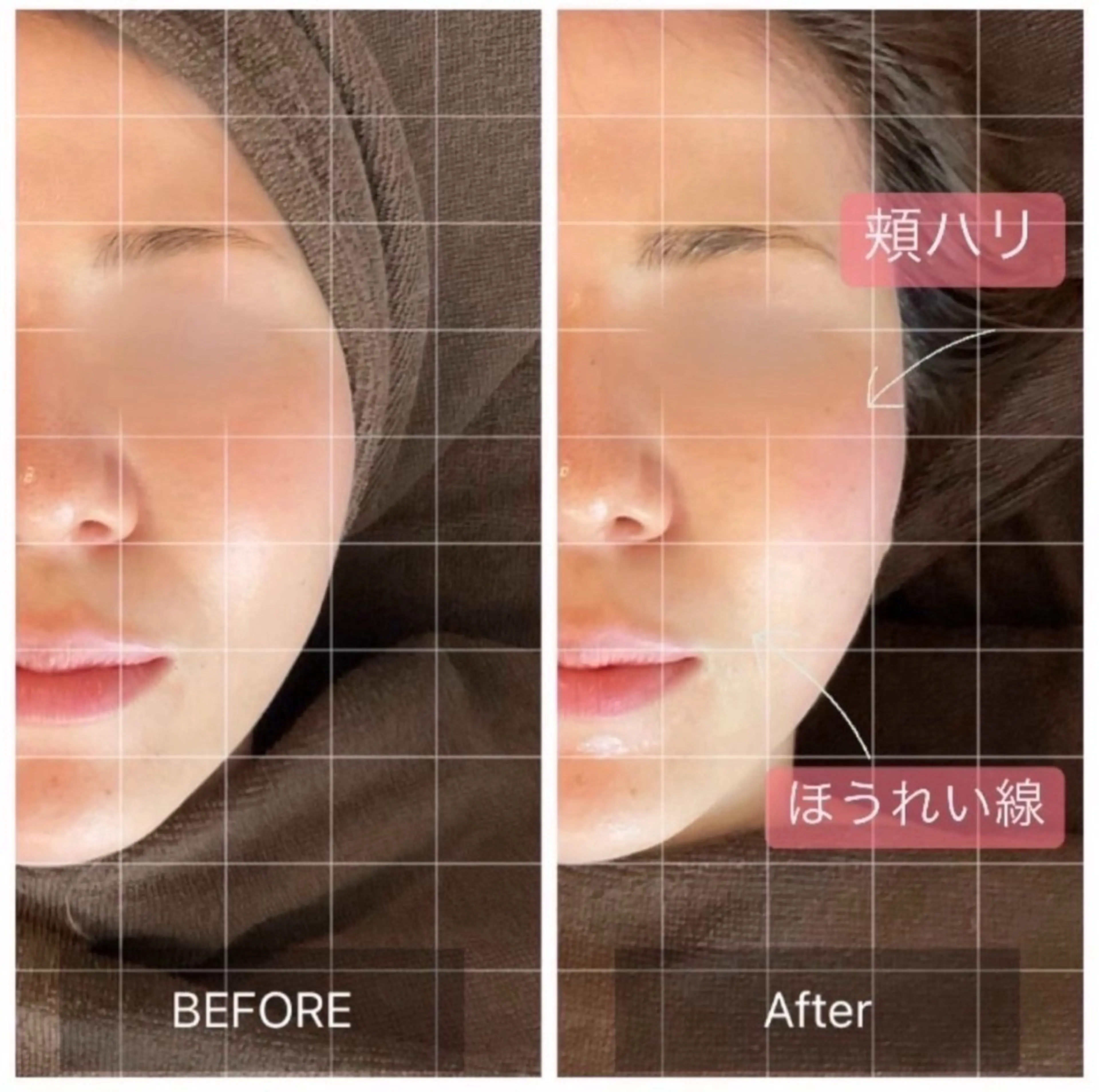 MIRAI小顔 心斎橋店のその他イメージ