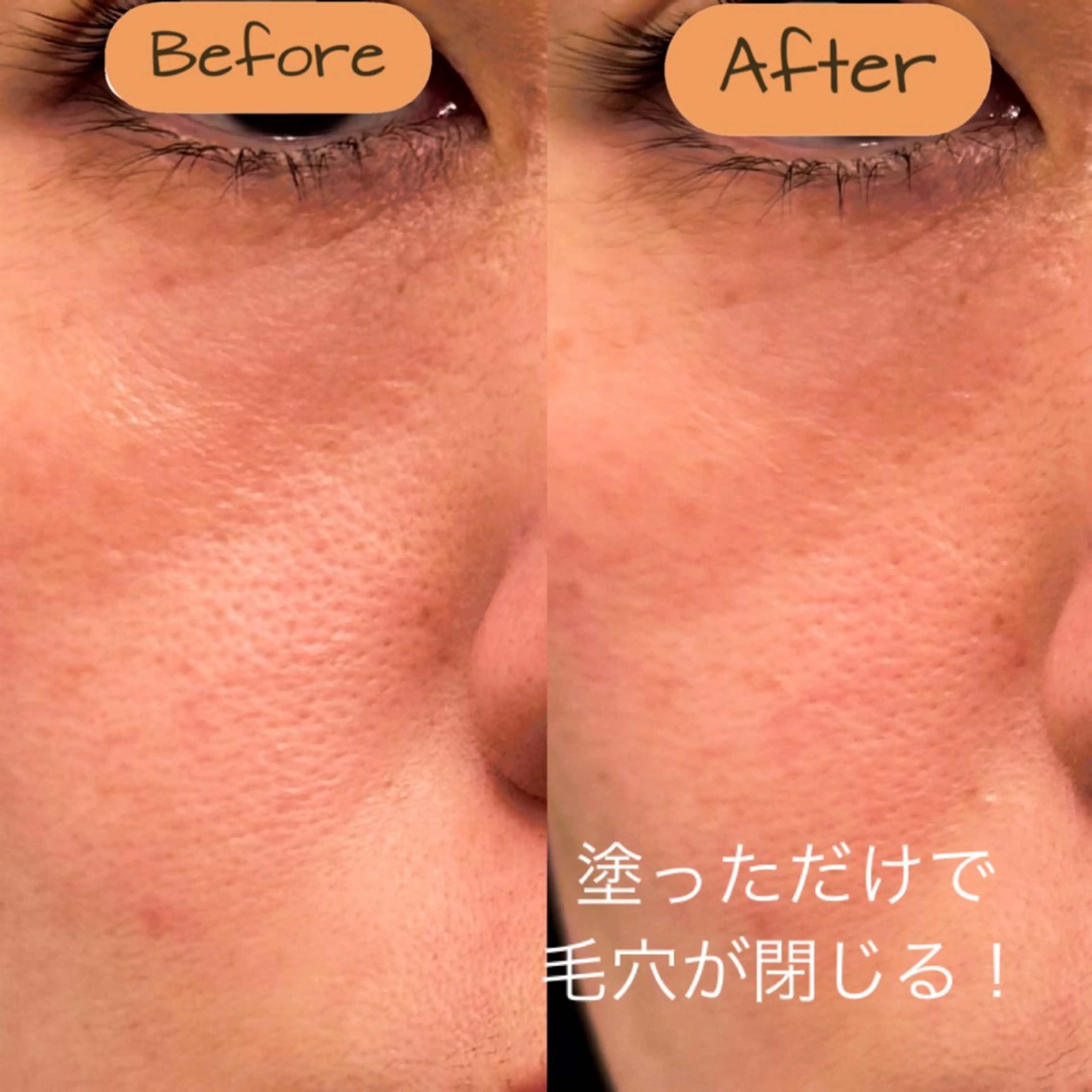 ファーマリジェネプレミアムインテンシブコース 25000円→12000円‼️の写真