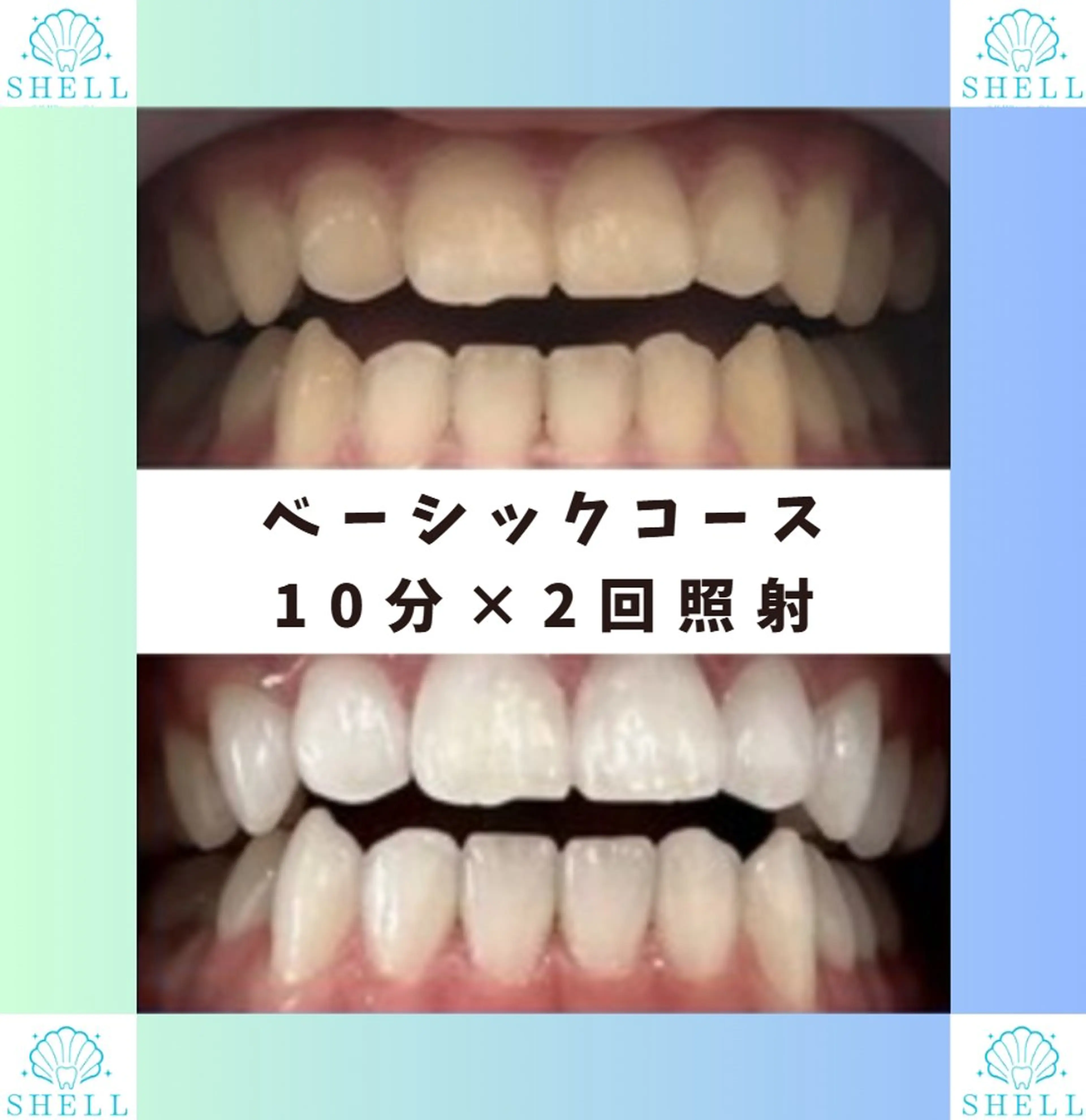 ネイル メンズ キッズ セルフホワイニング サロンSHELL木場のエステ・リラクイメージ