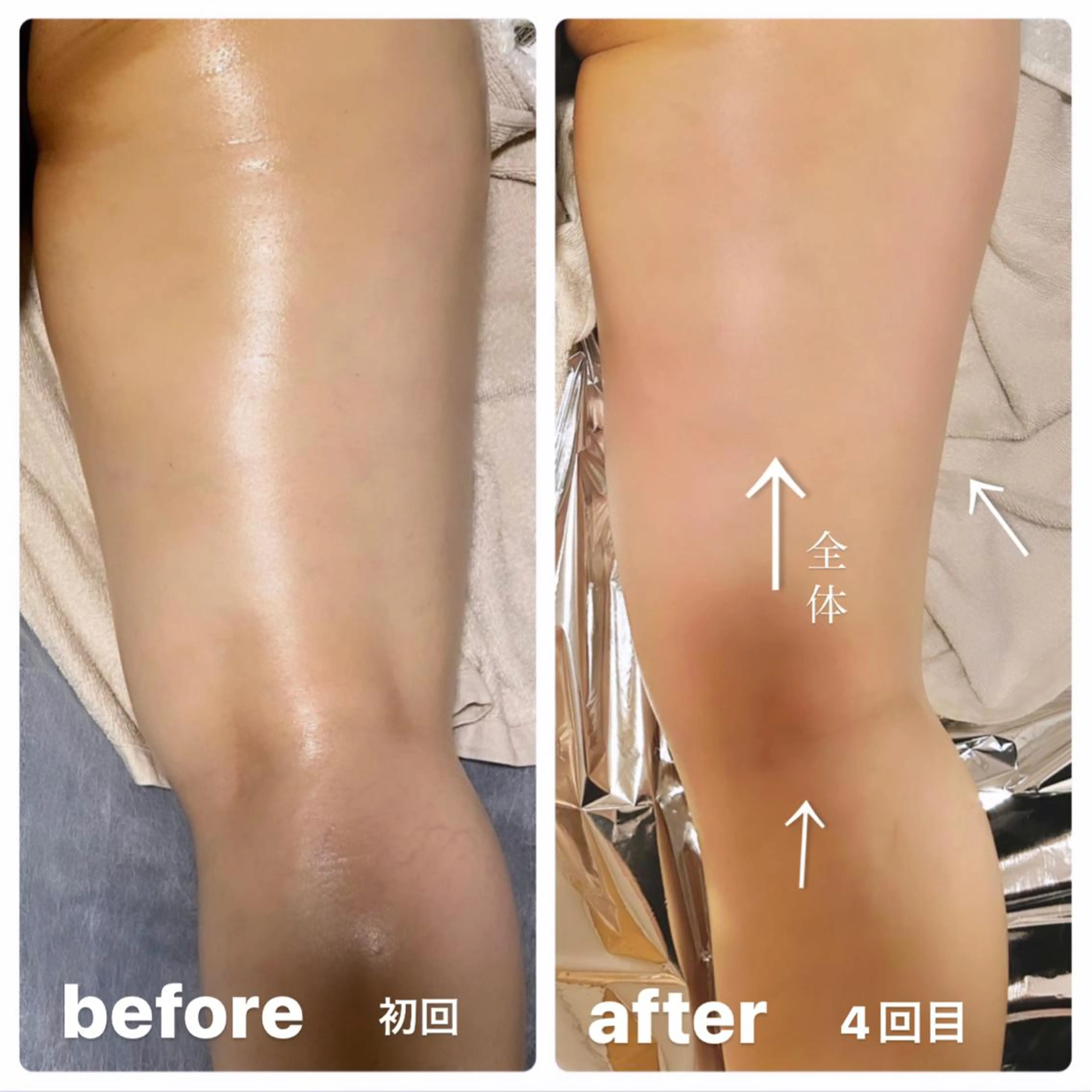 🌴Beauty Salon LANAのエステ・リラクイメージ