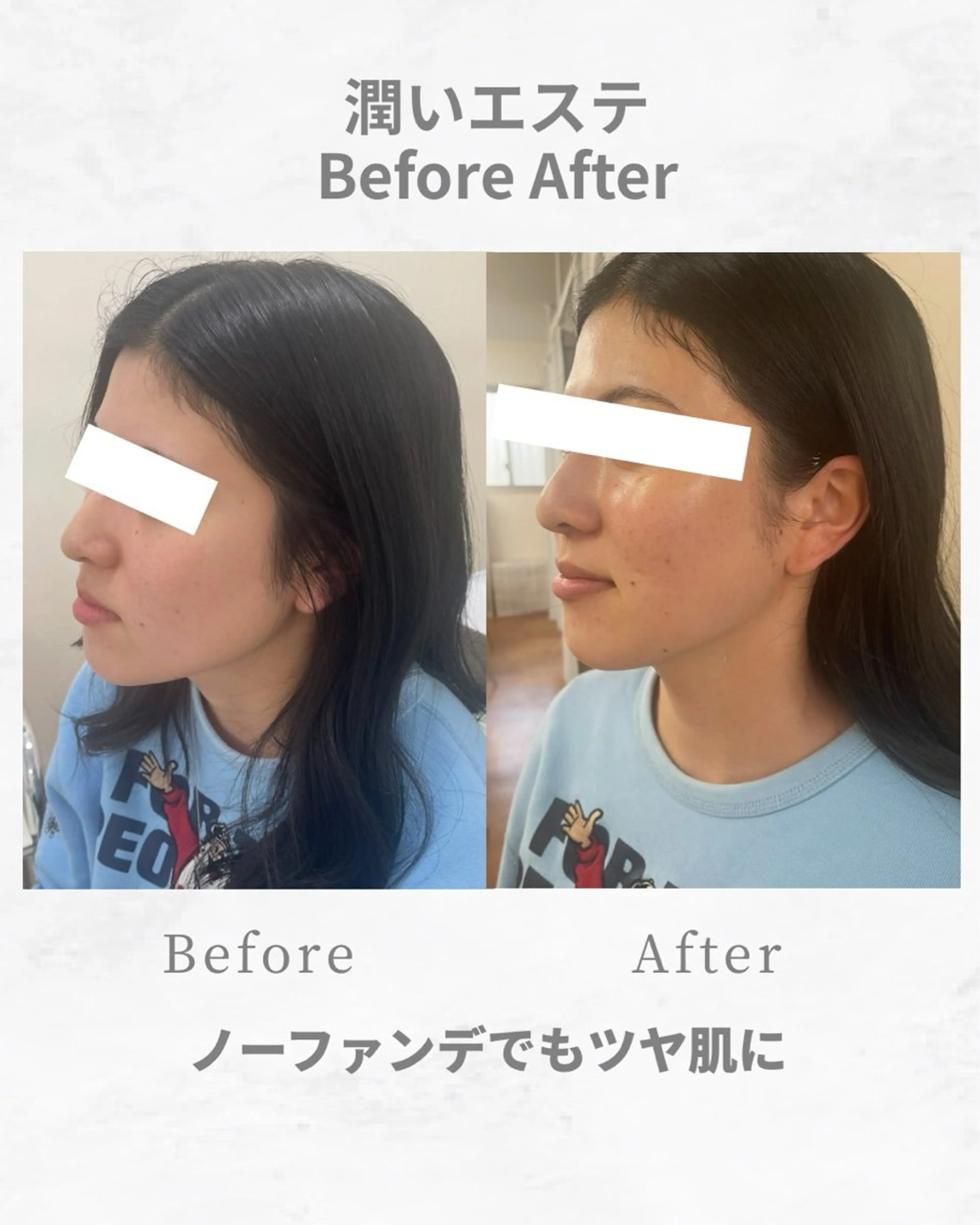 エステ nozomi.m🌷 narisのエステ・リラクイメージ