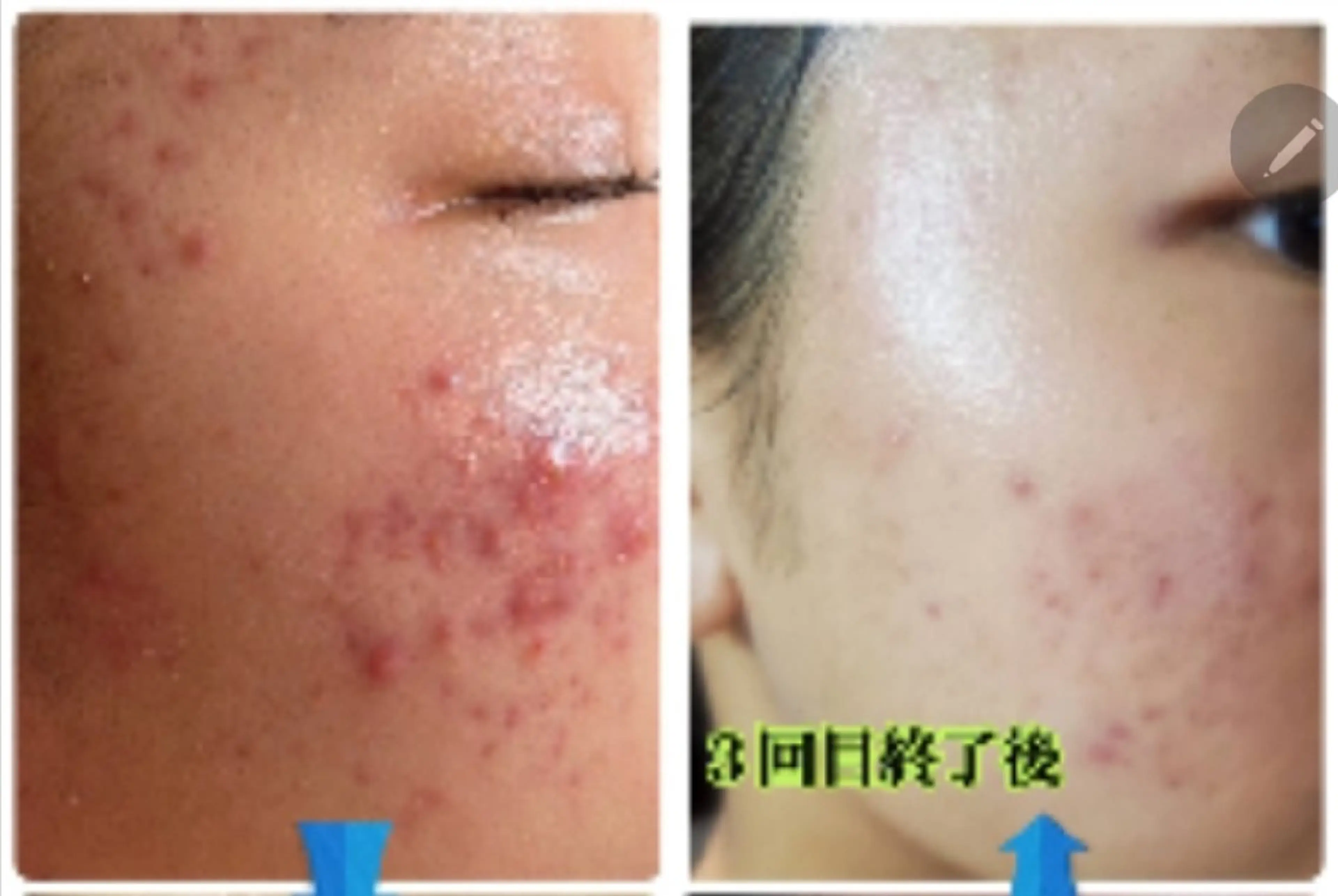 sbeaute  エスボーテのエステ・リラクイメージ